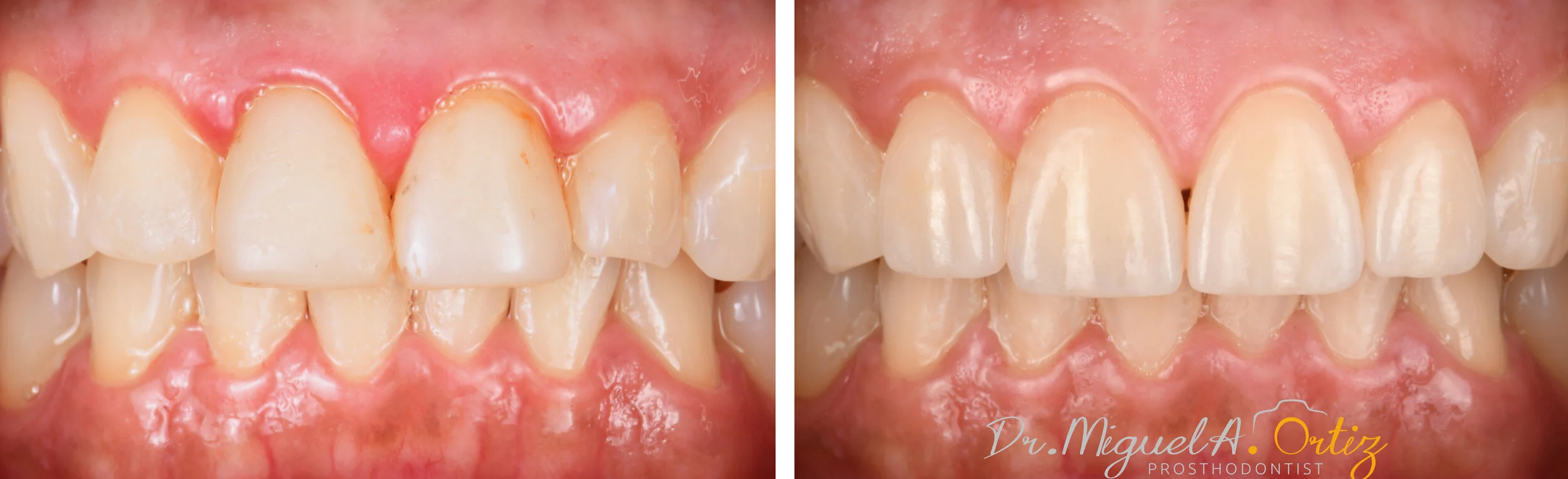 DSC_4301 No Sign copy 4.jpg