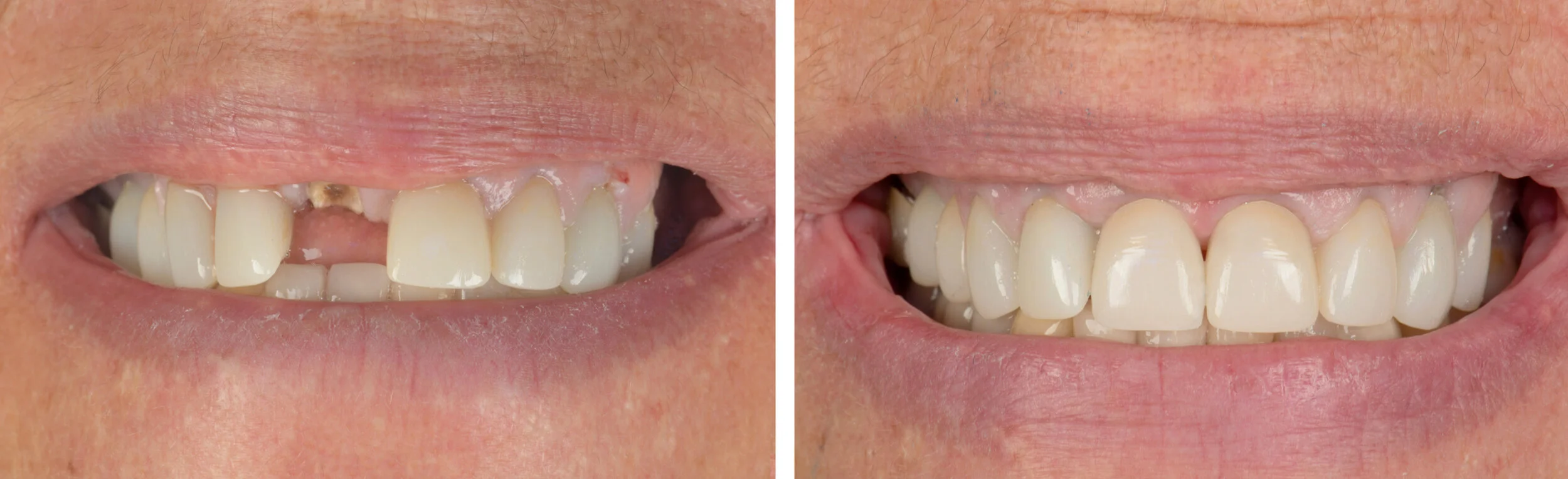 DSC_4301 No Sign 8.jpg