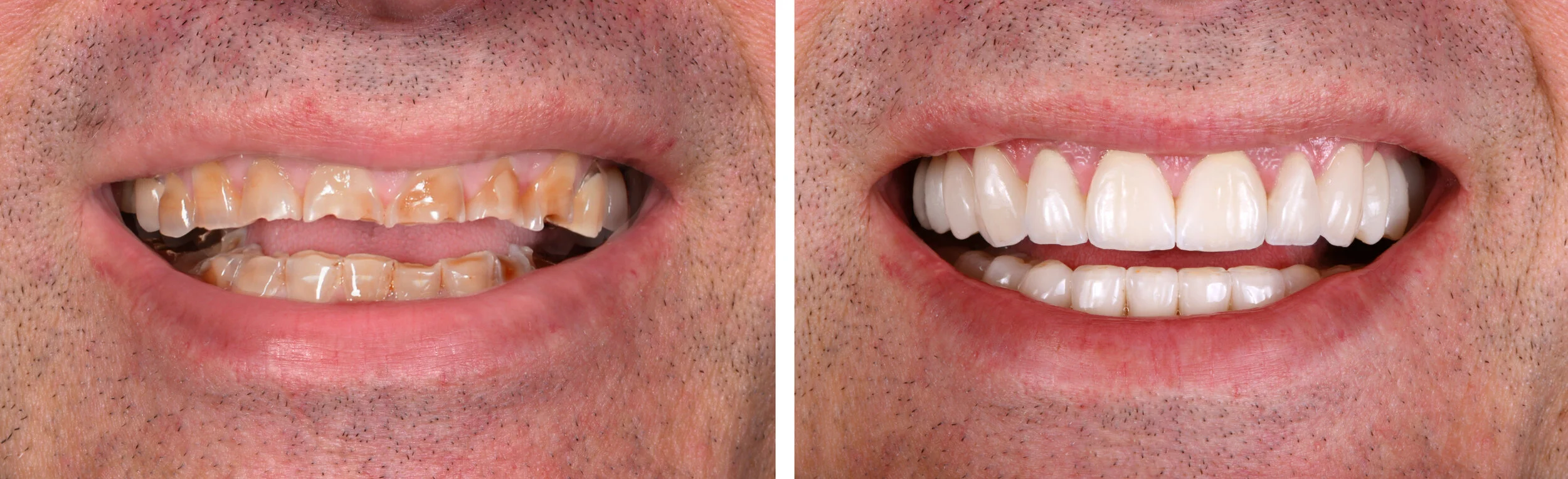 DSC_4301 No Sign copy.jpg