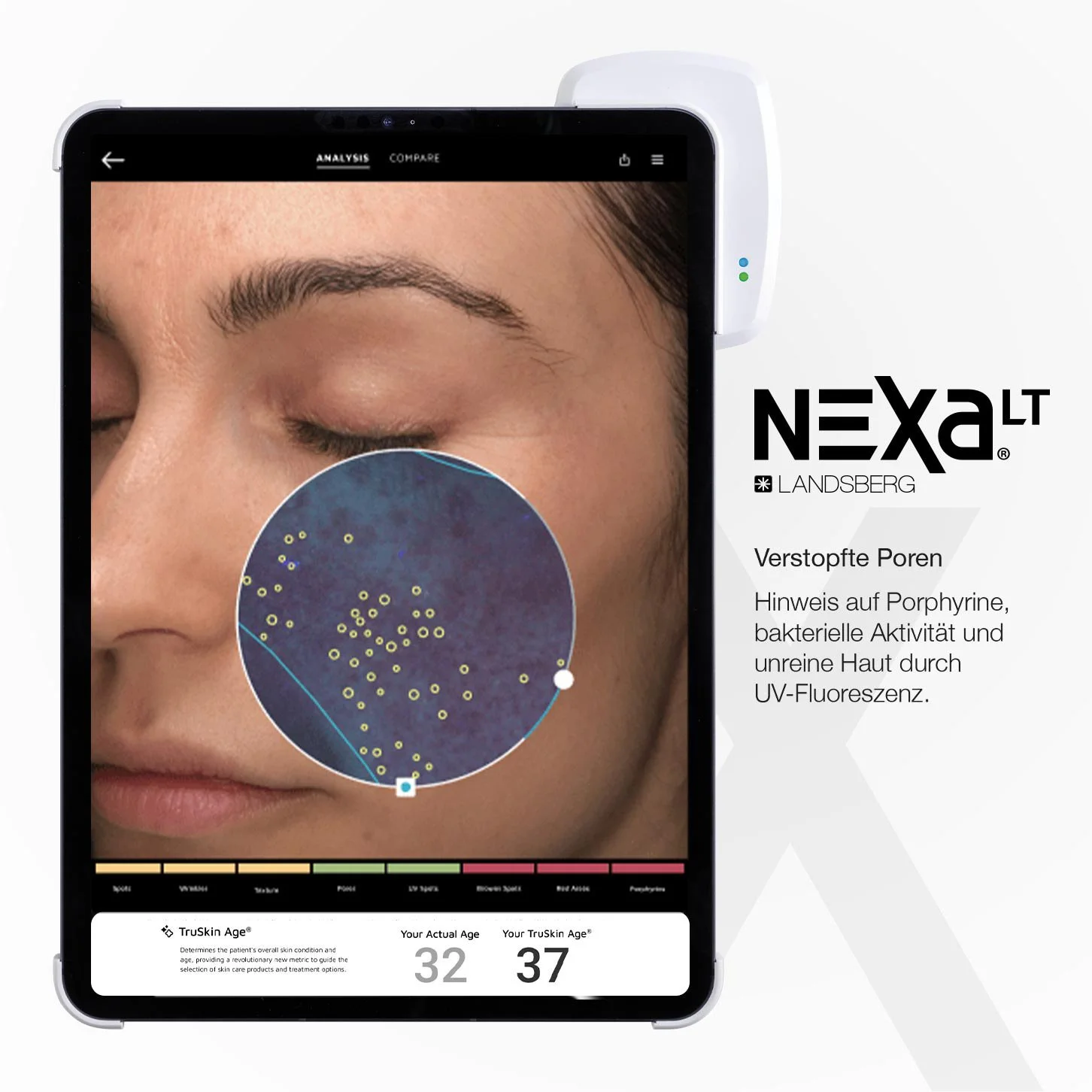 Auswertung der Hautanalyse mit NEXA LT.