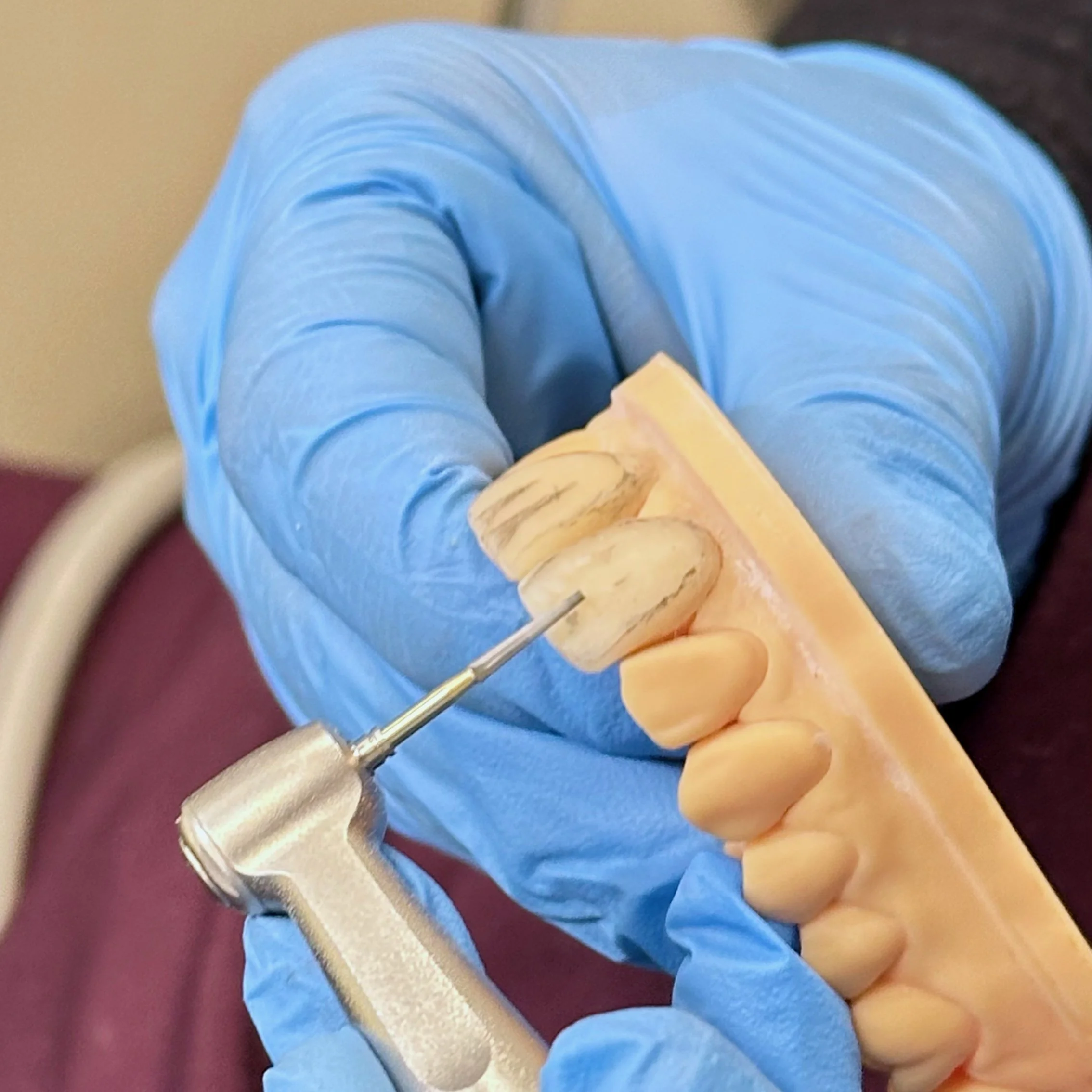 Rehabilitación oral para recuperar función y sonrisa