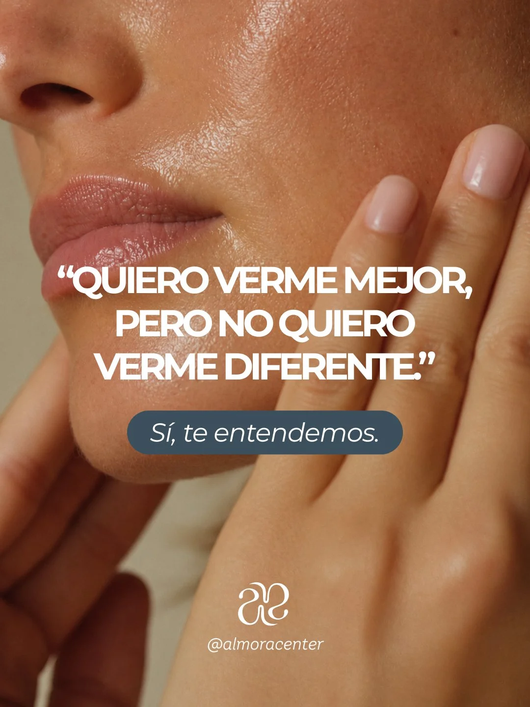 Quiero verme mejor, pero no quiero verme diferente. 🤍

En Almora entendemos las dudas antes de un tratamiento est&eacute;tico: que se note demasiado, que no te guste el resultado, que termines vi&eacute;ndote artificial.

Por eso, antes de hablar de