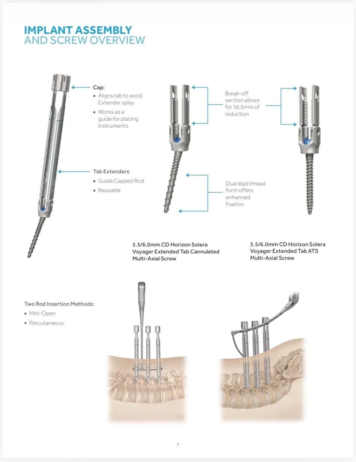 Minimally invasive posterior lumbar fusion 3.jpg