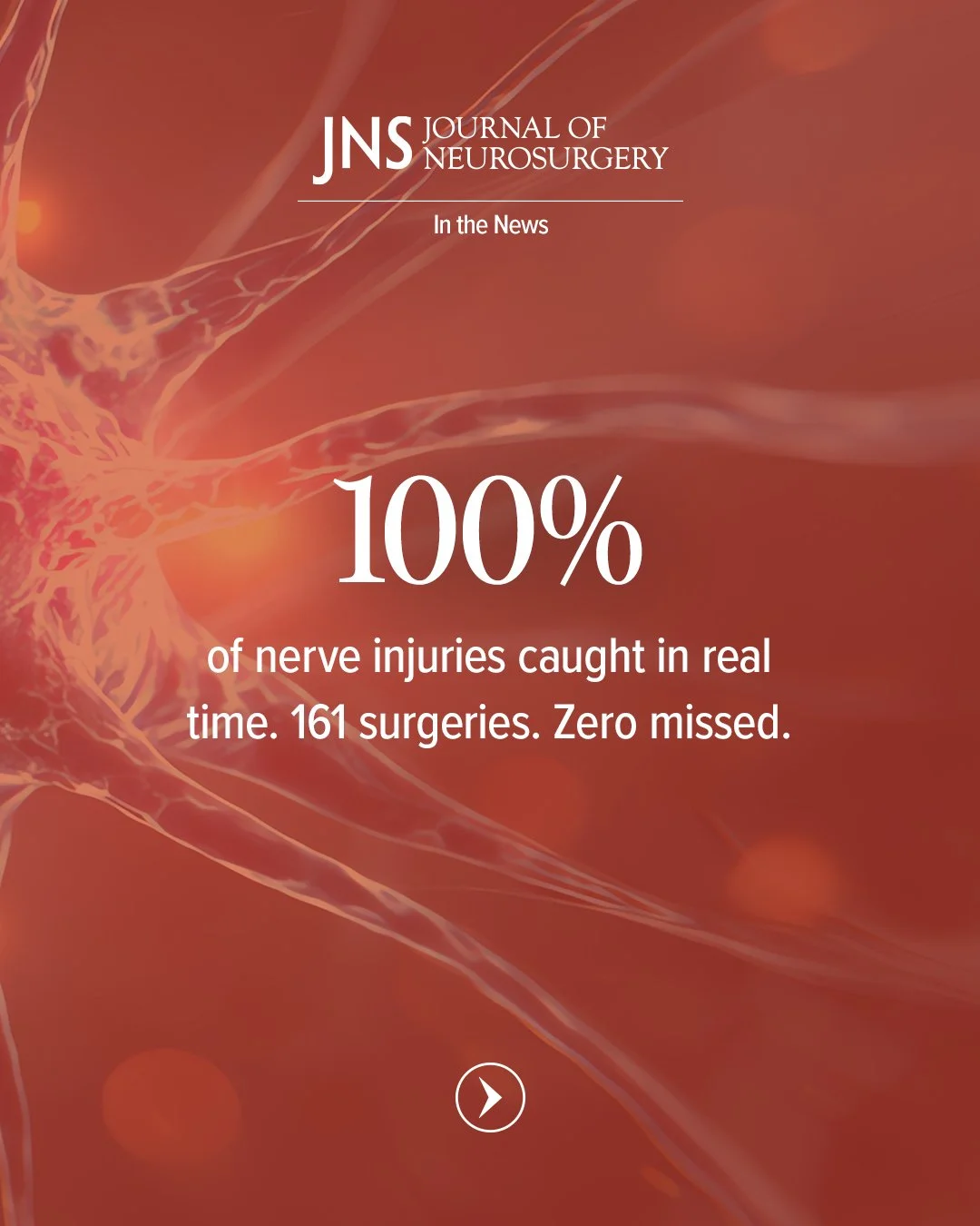 What if your surgeon could catch a nerve injury the moment it happens, not after? 

Our own Dr. Michael Conti Mica contributed to this new study in the Journal of Neurosurgery: Spine, helping push spine surgery toward safer, more precise outcomes.