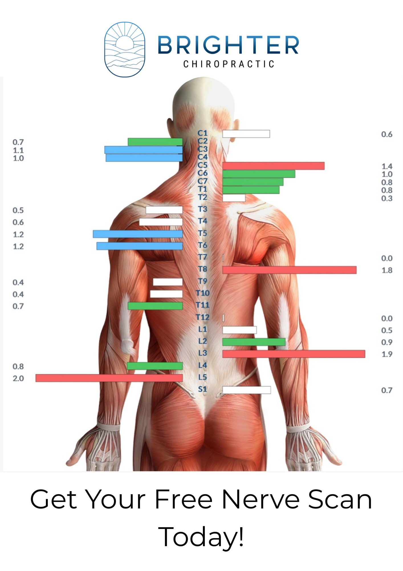 An anatomical illustration of a human back with muscular and skeletal details, overlaid with a chart of nerve roots, and the text 'Brighter Chiropractic' at the top. Brighter Chiropractic - Chiropractic Care in Harrisonburg, Virginia.