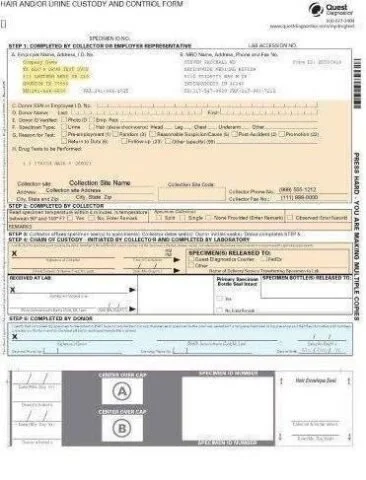 Laboratory form titled 'Hair and Urine Drug and Alcohol Testing' with sections for collection details, collector information, lab results, and specimen release, containing handwritten entries and checkboxes.
