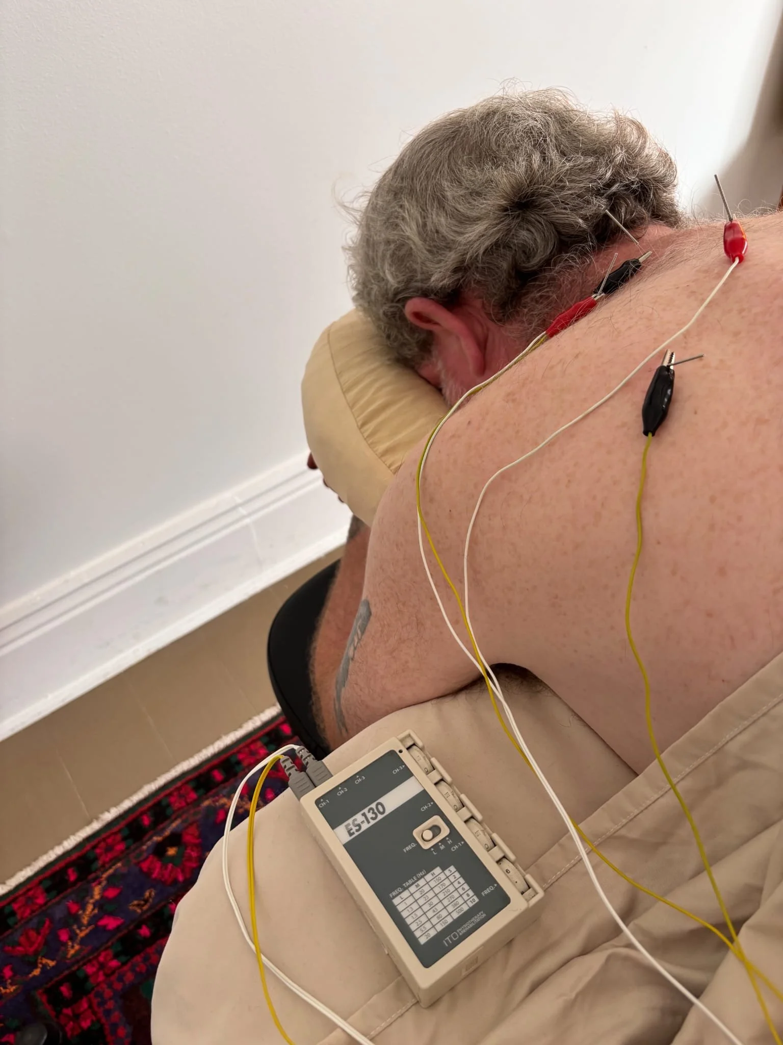 A person lying face down on a medical examination table with multiple electrodes attached to their back, connected to a medical device for an electrical activity test.