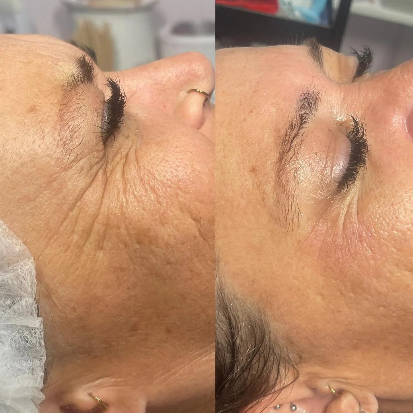 Before and 8 weeks later