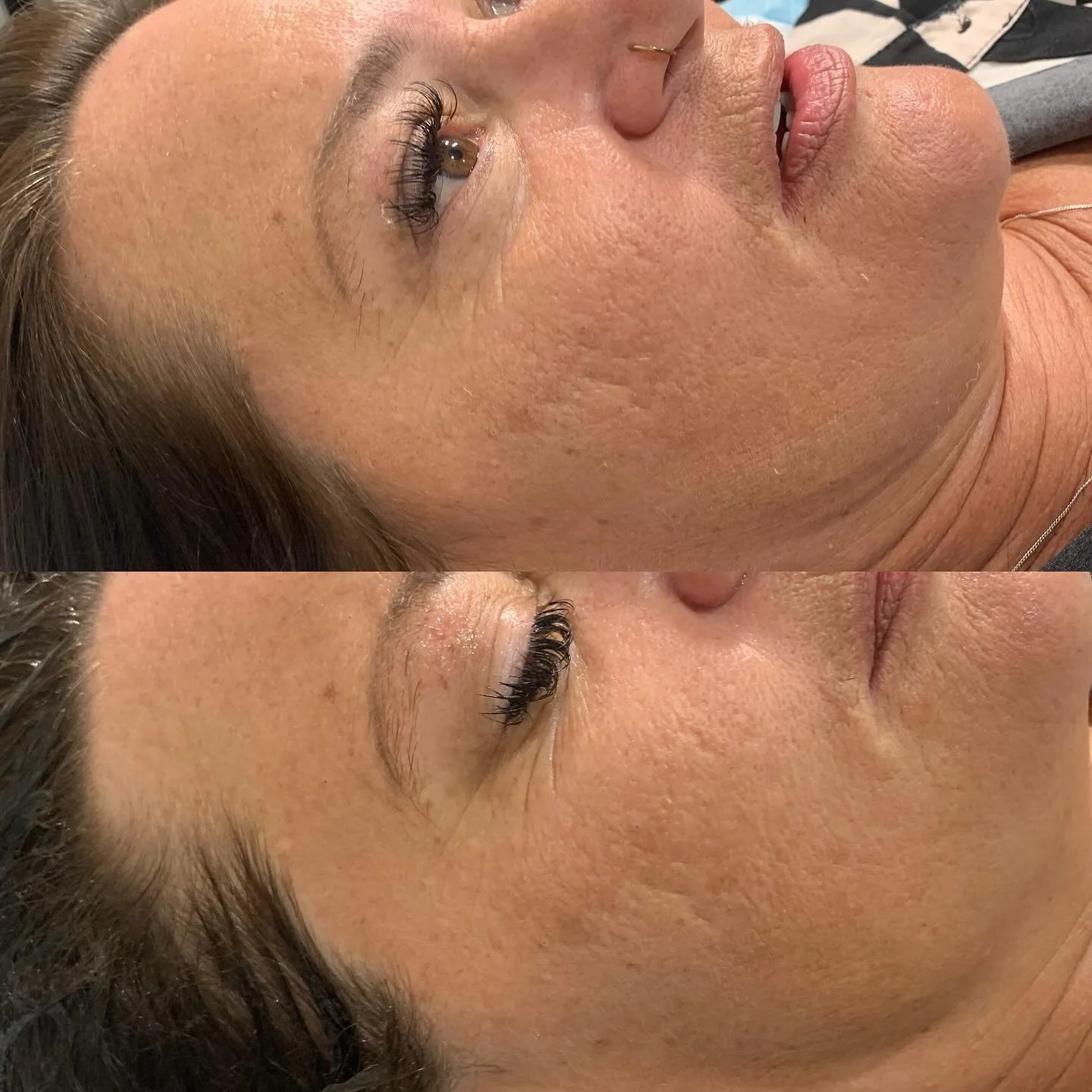 BEFORE & 8 WEEKS LATER 