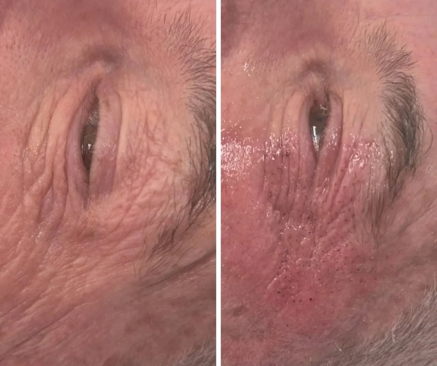 Side-by-side close-up images of a person's eye and surrounding skin, showing the eye partially closed and the skin with visible wrinkles and pores.