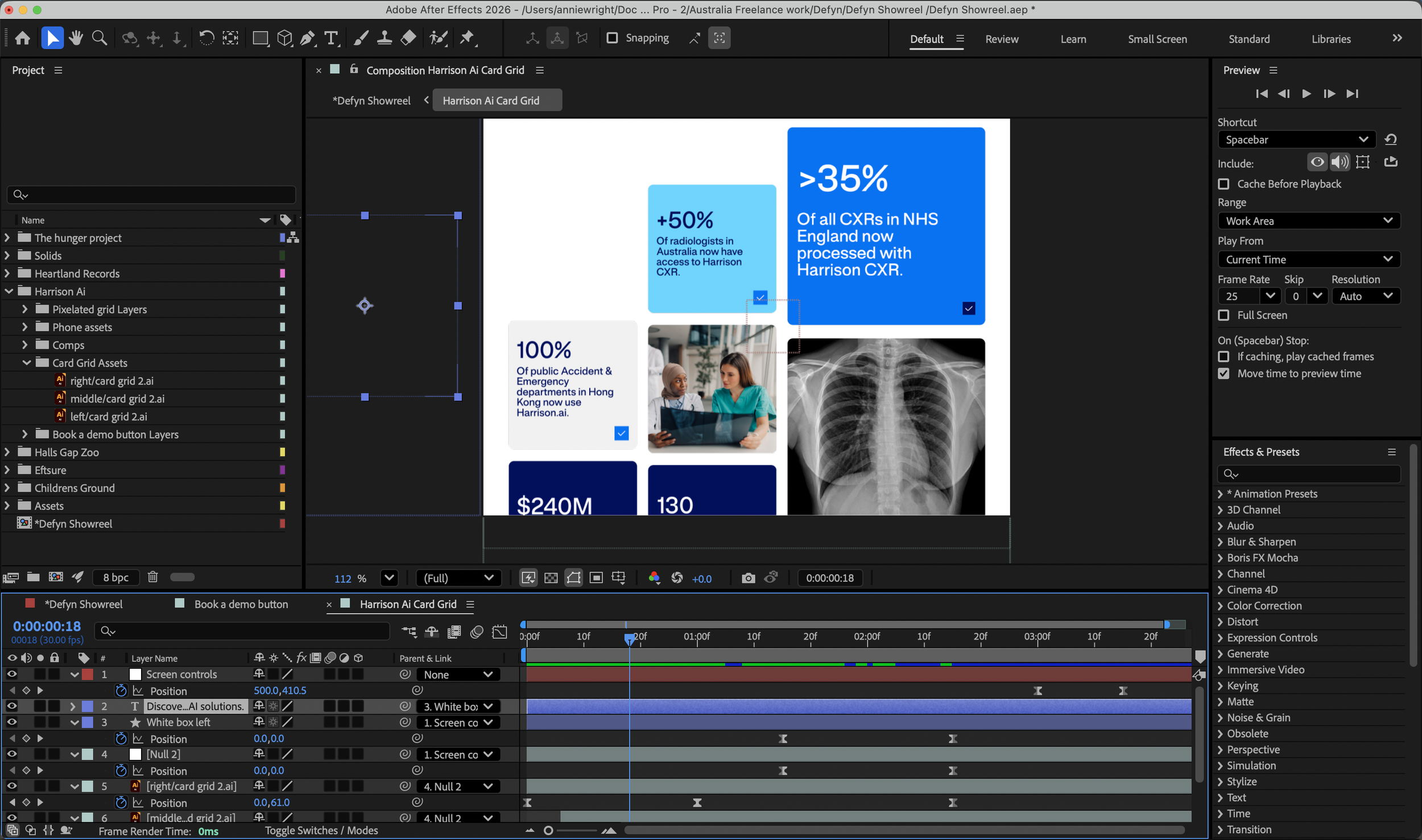 Screenshot of Adobe After Effects with a presentation slide showing statistical data and images, including two women discussing at a desk and a chest X-ray.