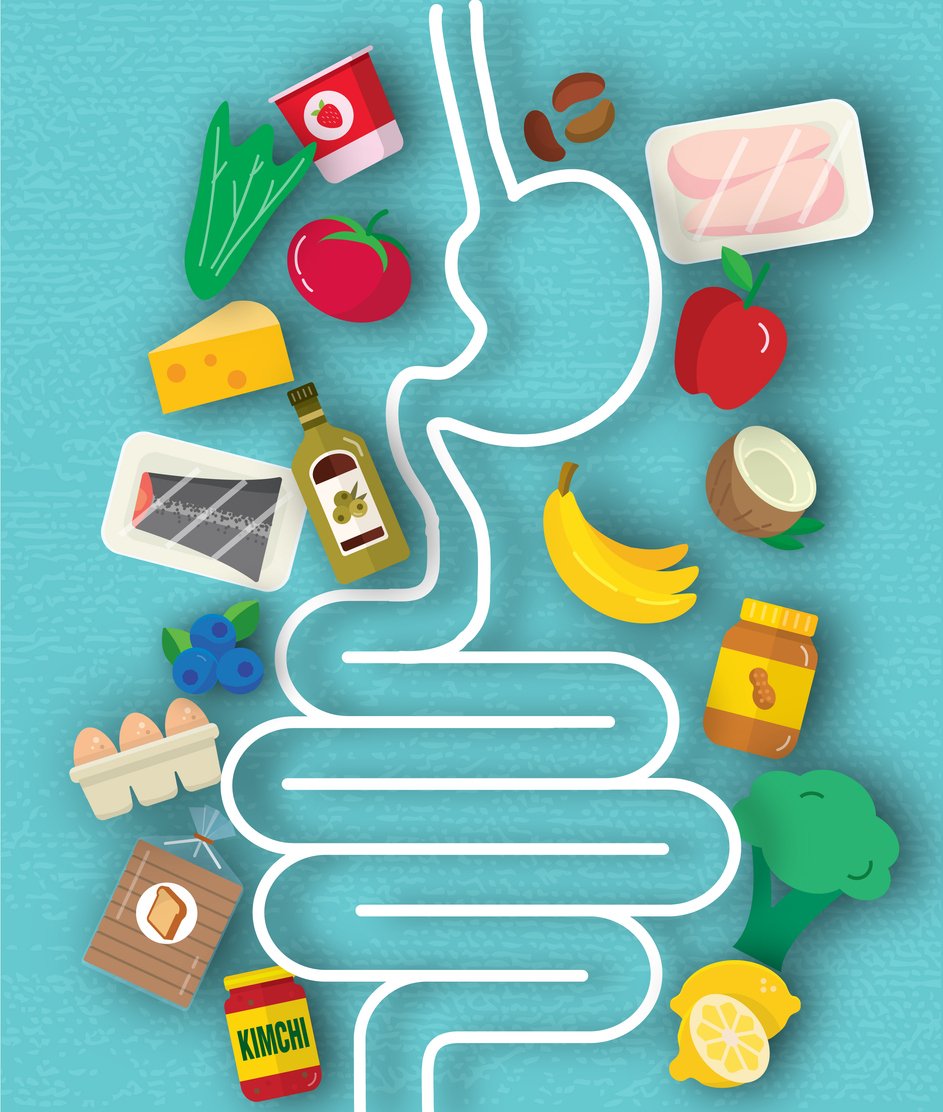 Illustratie van het spijsverteringsstelsel met verschillende voedingsmiddelen bij een artikel over het FODMAP-dieet.
