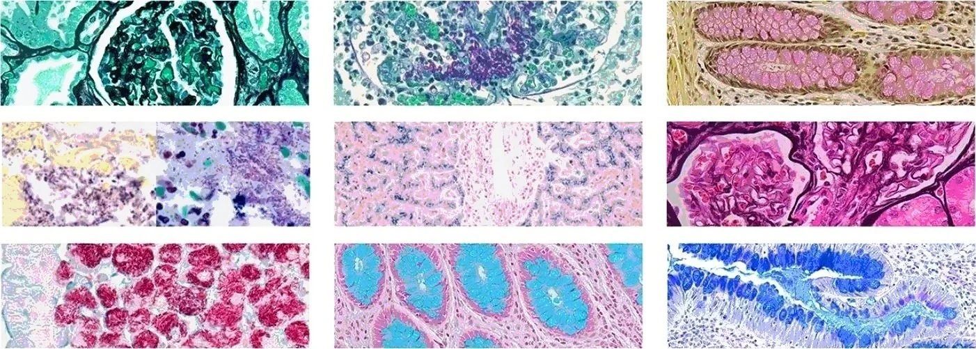 A collage of nine microscopic images showing different specials stains performed on tissue slides to help pathologists make their diagnosis.