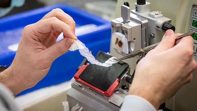 A histotech cutting sections on a microtome is about to take a ribbon and place it into a flotation bath.