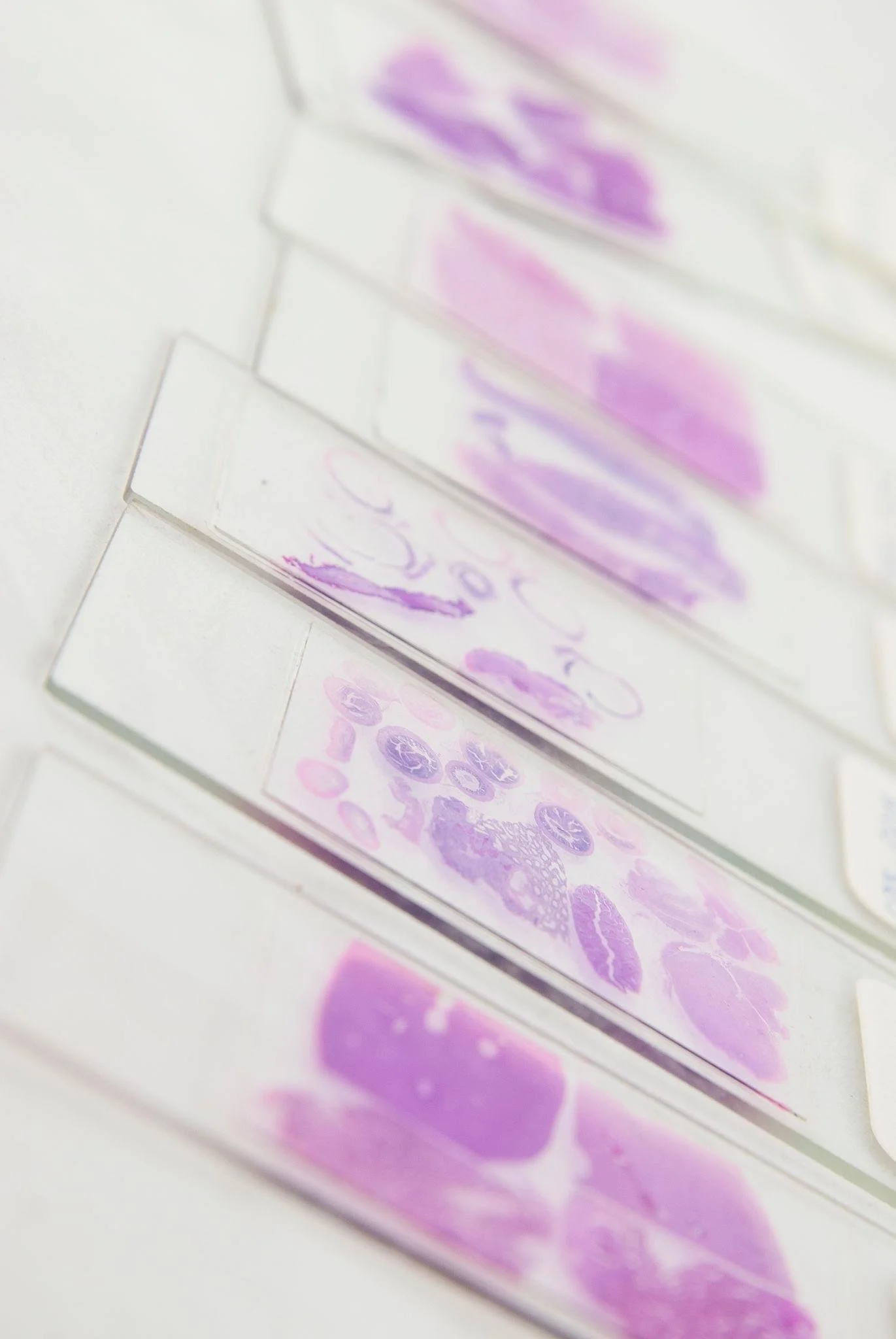 Close-up of glass microscope slides with hematoxylin and eosin stained tissues, arranged in a row.