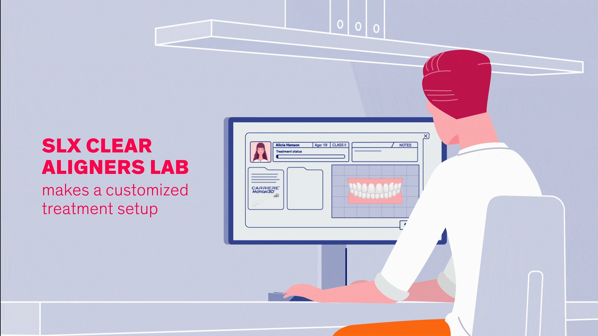 SLX Clear Aligners