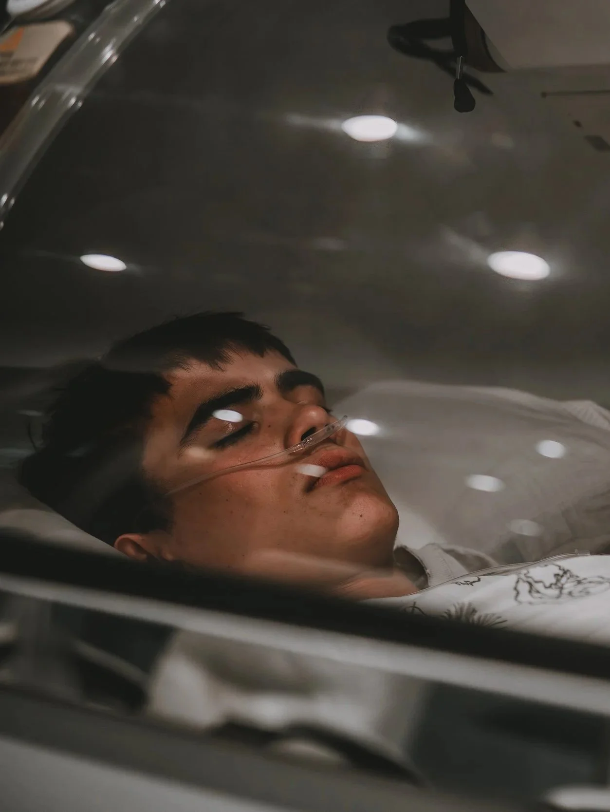 Example of Hyperbaric Oxygen Therapy