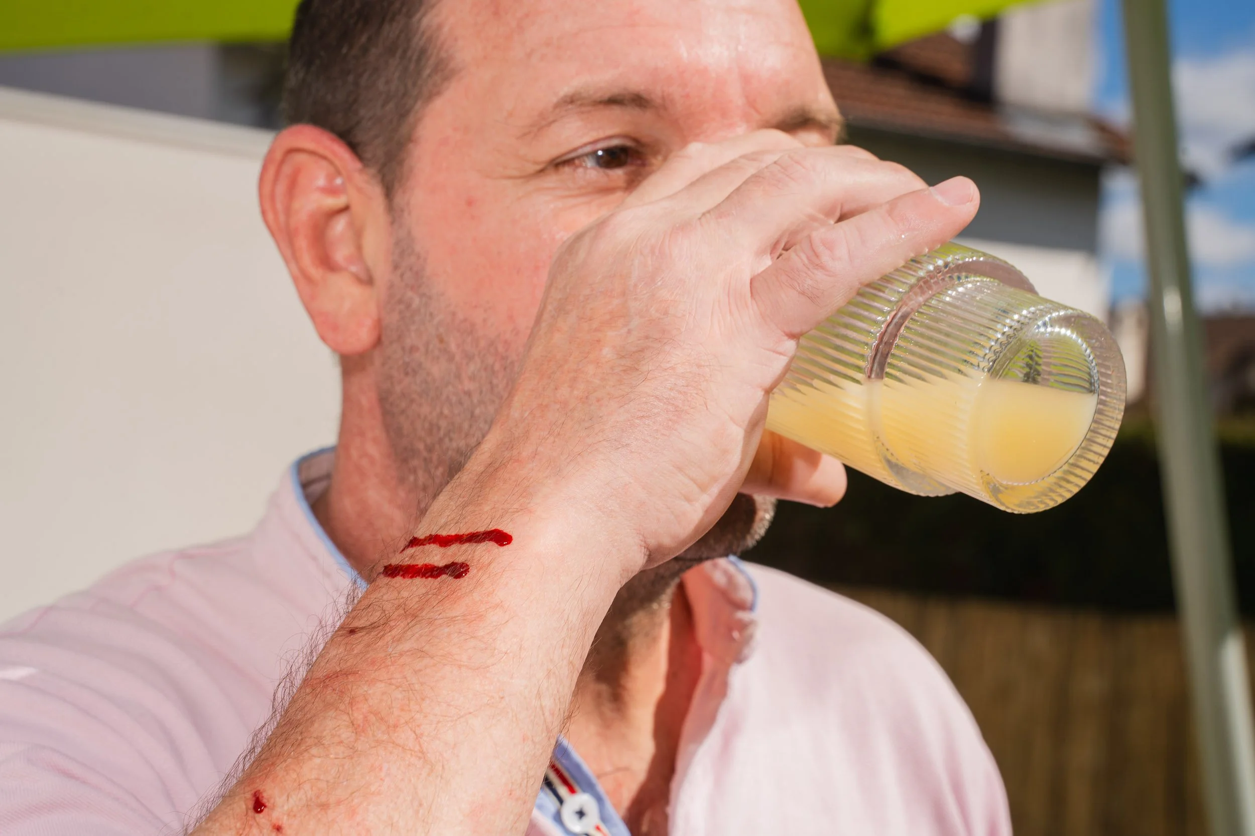 A man drinking orange juice from a glass outdoors, with visible injuries on his forearm.