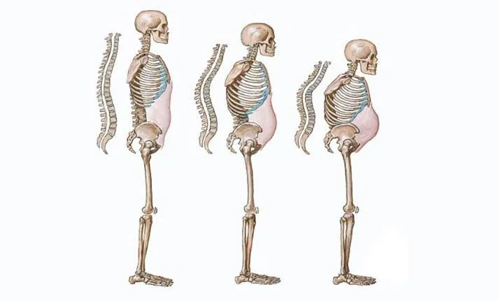 Testosterone and Bone Health: What Men Need to Know About Preventing Osteoporosis