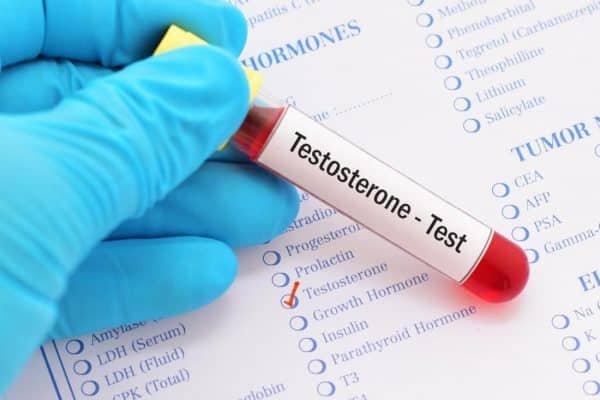 Testosterone Replacement Therapy Cost: A Comprehensive Guide