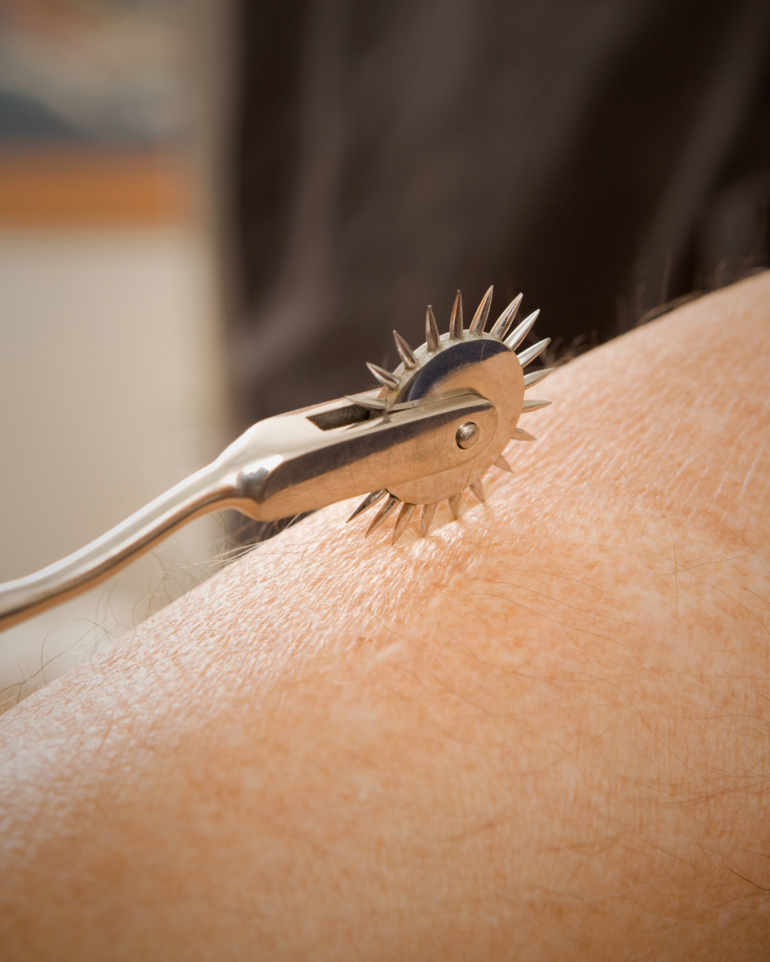 Close-up of a foot roller with metal spikes rolling on a person's skin during a therapy session.