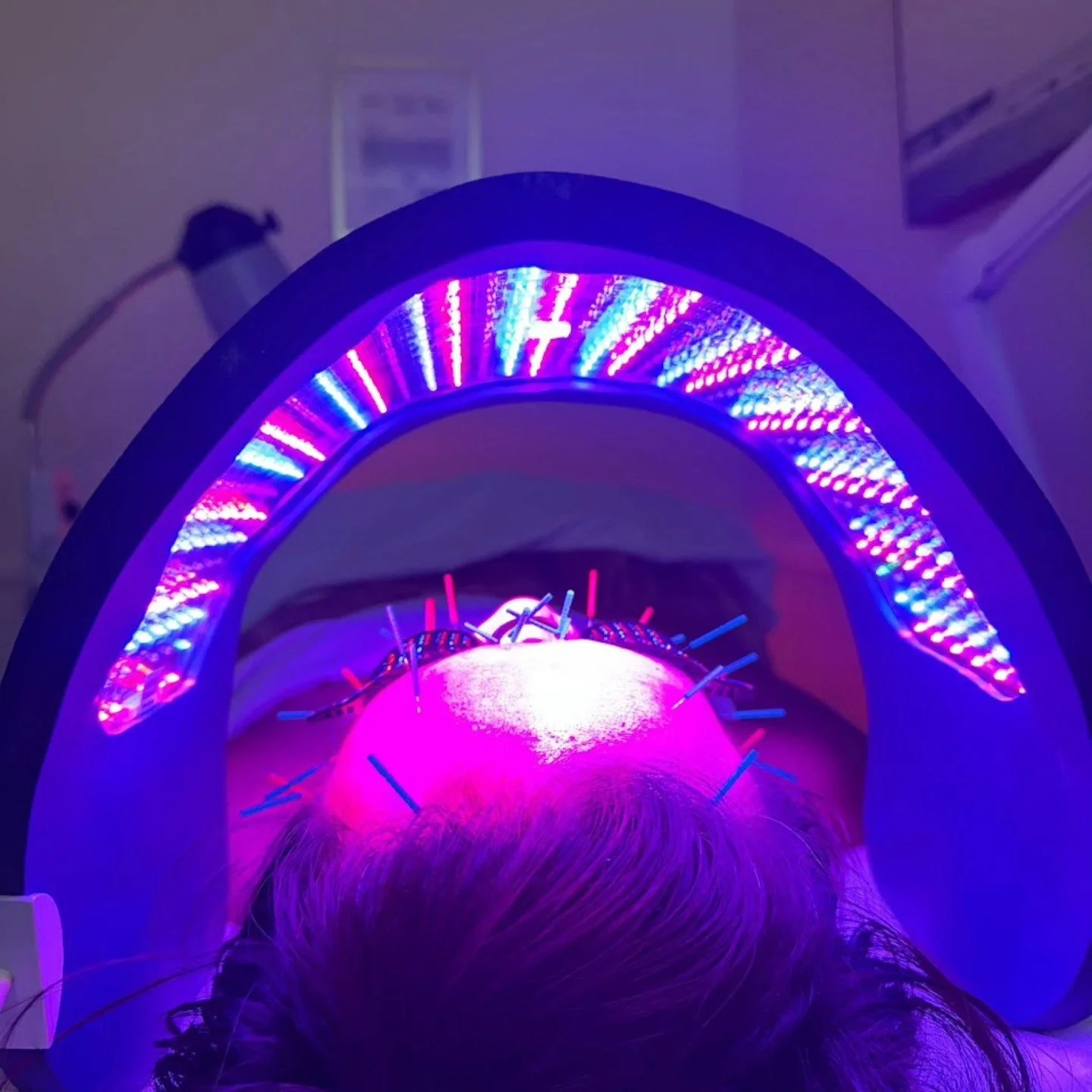 Treat Mom to something truly special this Mother&rsquo;s Day with an acupuncture facial &mdash; a relaxing, rejuvenating experience that enhances natural beauty from within. Because she deserves to feel as radiant as she is!

Happy Mother's day! 🌺🥰