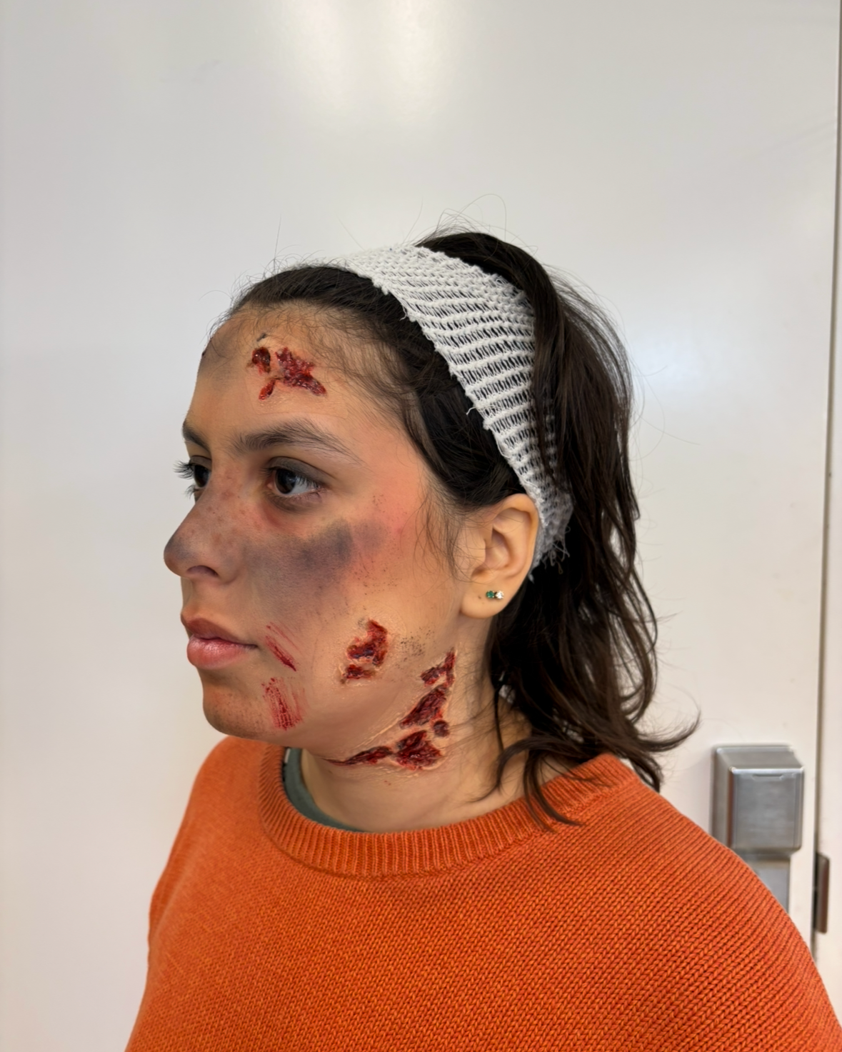 Injury Prosthetics Application