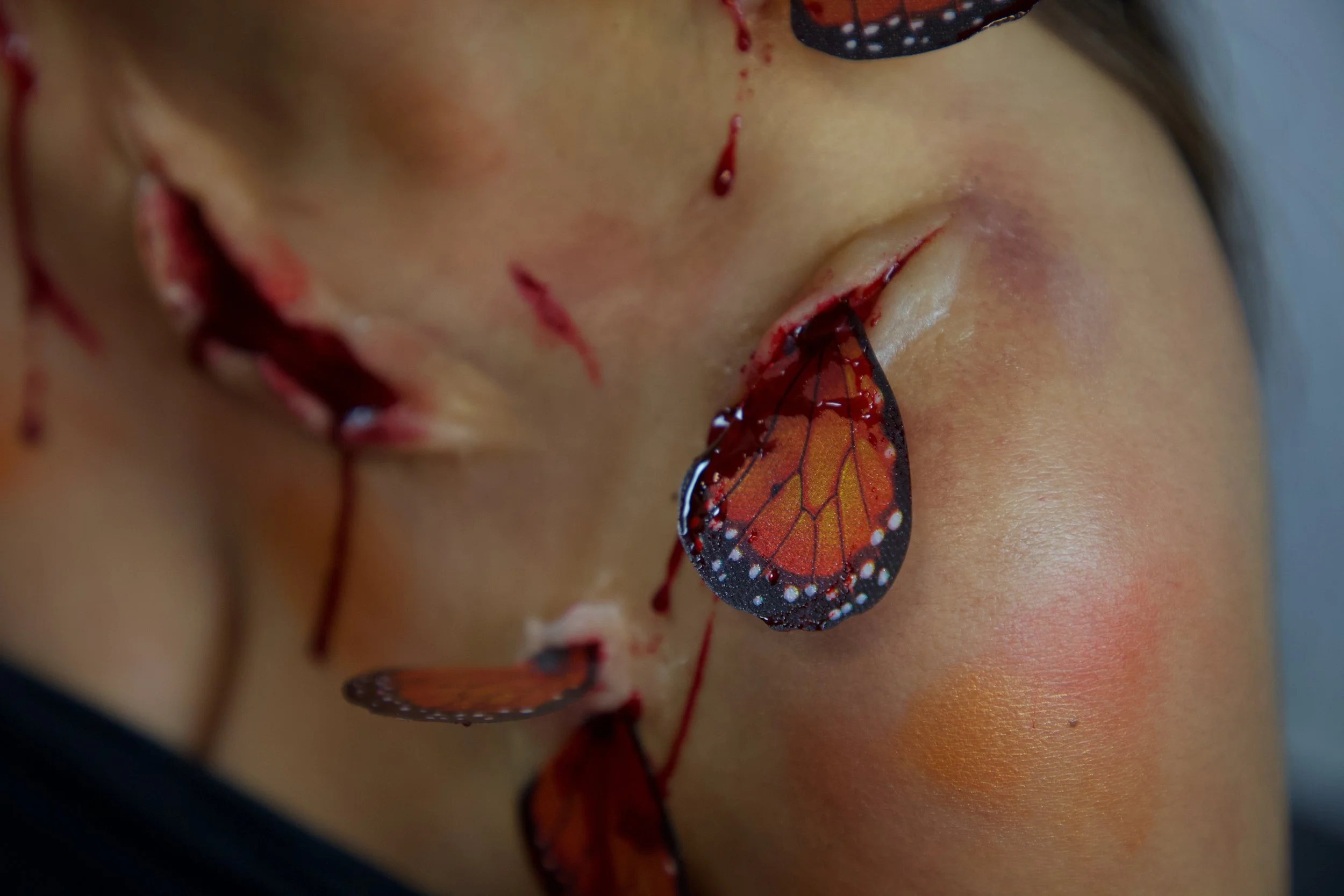 Injury Application: Design by Finty Critchley