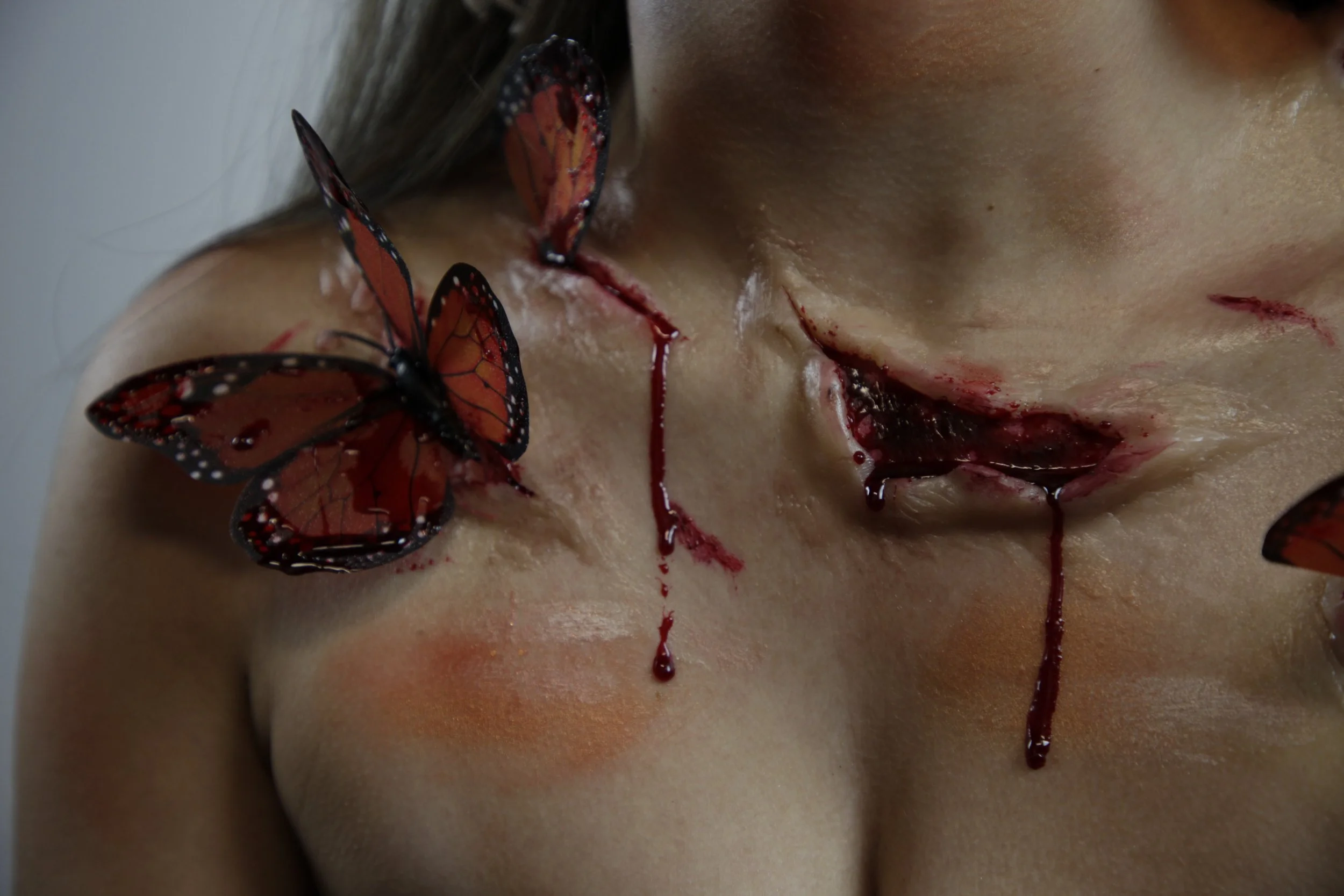 Injury Application: Design by Finty Critchley