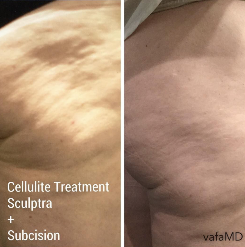 Screen Shot 2018-05-09 at 9.33.32 PM.png