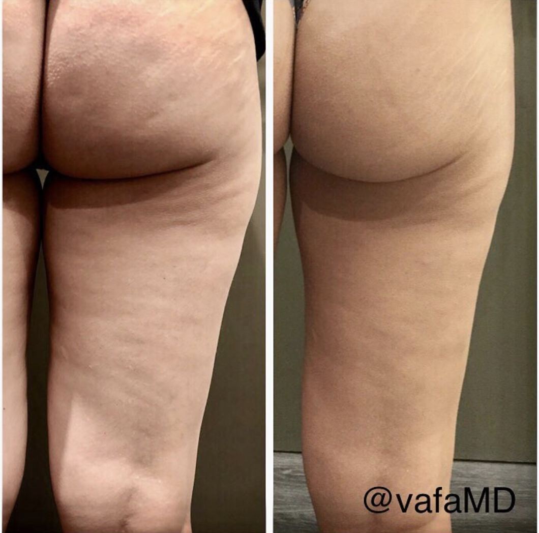 Screen Shot 2018-05-11 at 7.54.11 PM.png