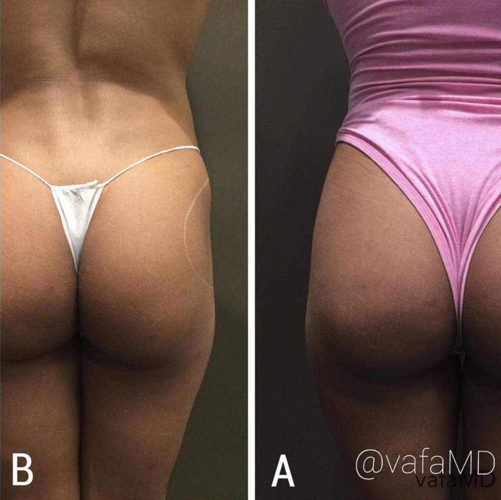 Screen Shot 2018-05-09 at 9.33.17 PM.png