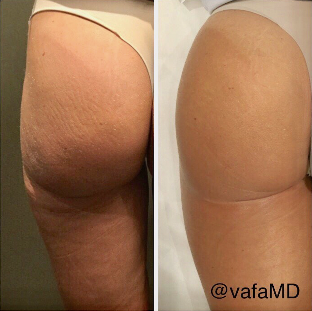 Screen Shot 2018-05-09 at 9.33.00 PM.png