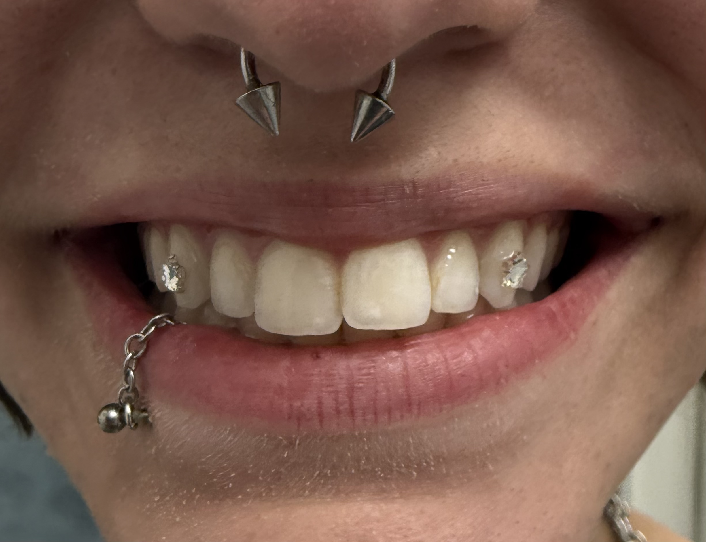 Close-up of person's mouth showing teeth, tongue, and nose, with piercings on the nose and a chain on the lower lip.