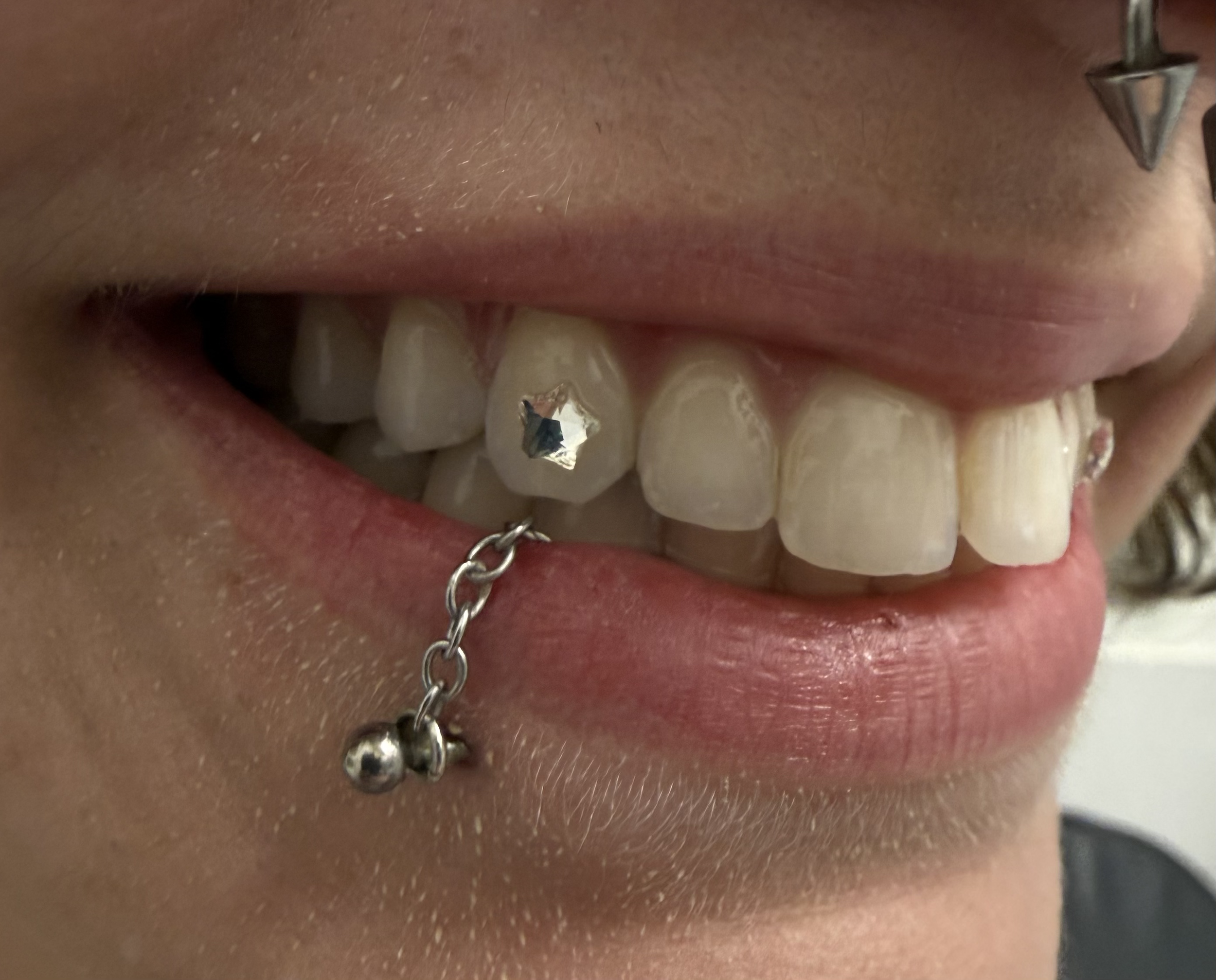Close-up of a person's nose, partially showing a silver nose ring with a dangling ball, a silver star-shaped piercing on the upper cheek, and part of the person's mouth with teeth visible.