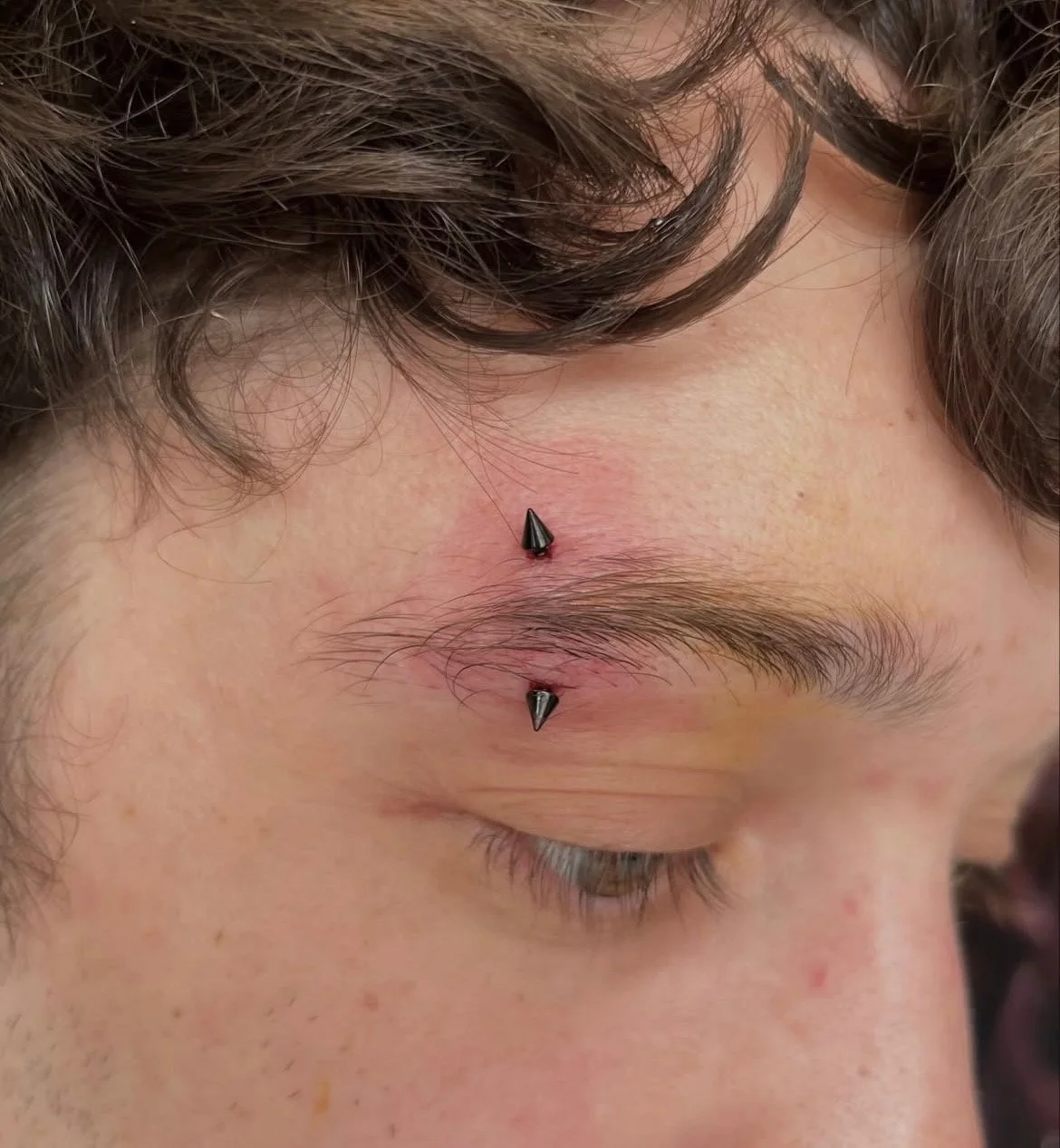 Close-up of a person's face with two black eyebrow piercings, one above the eyebrow and one below, surrounded by slightly red skin.