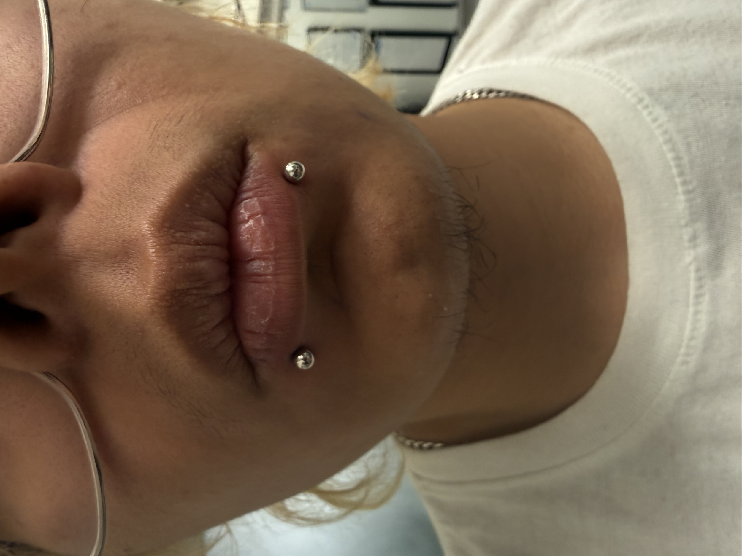 Close-up of a person's lips and chin, showing a silver lip piercing, with part of their face and a white shirt visible.