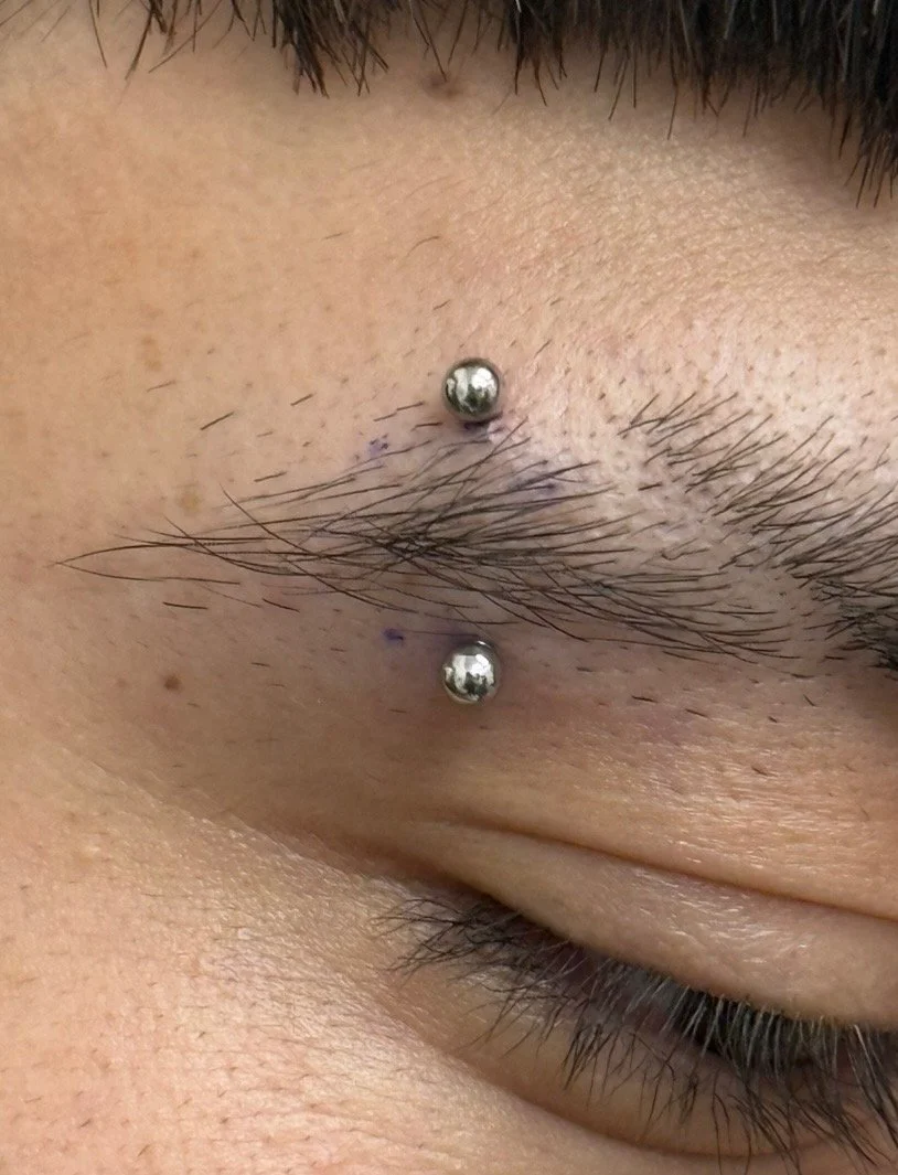Close-up of a person's face showing a dermal piercing above the upper lip near the nose, with two small shiny metal beads as jewelry.