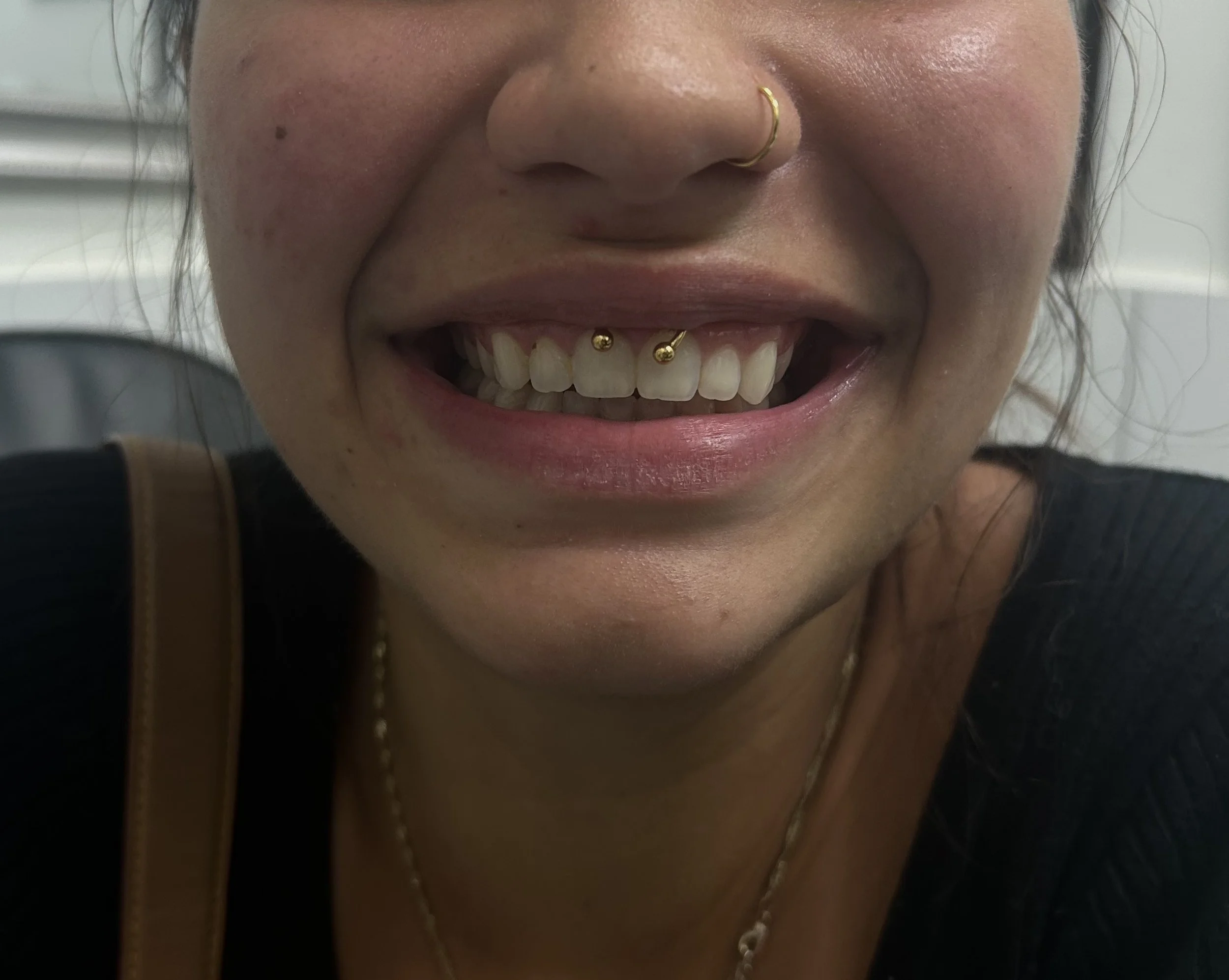 A person smiling, showing their teeth with two gold dental piercings, a nose ring, and a lip ring.