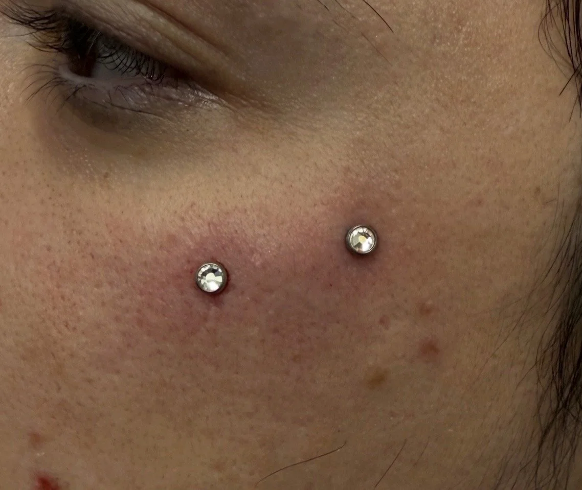 Close-up of a person's cheek with two dermal piercings containing small clear gemstones.