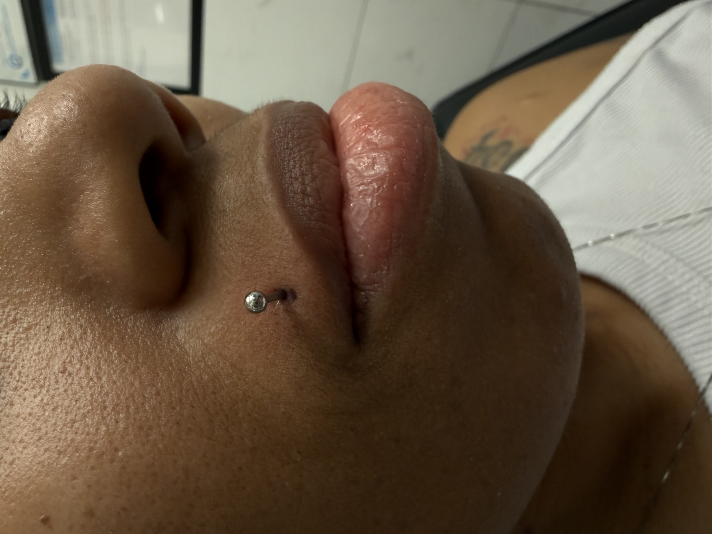 Close-up of a person's face showing a nose, lips, and a nose piercing with a ball ring. The person is lying on their back, and part of their face and upper chest are visible.