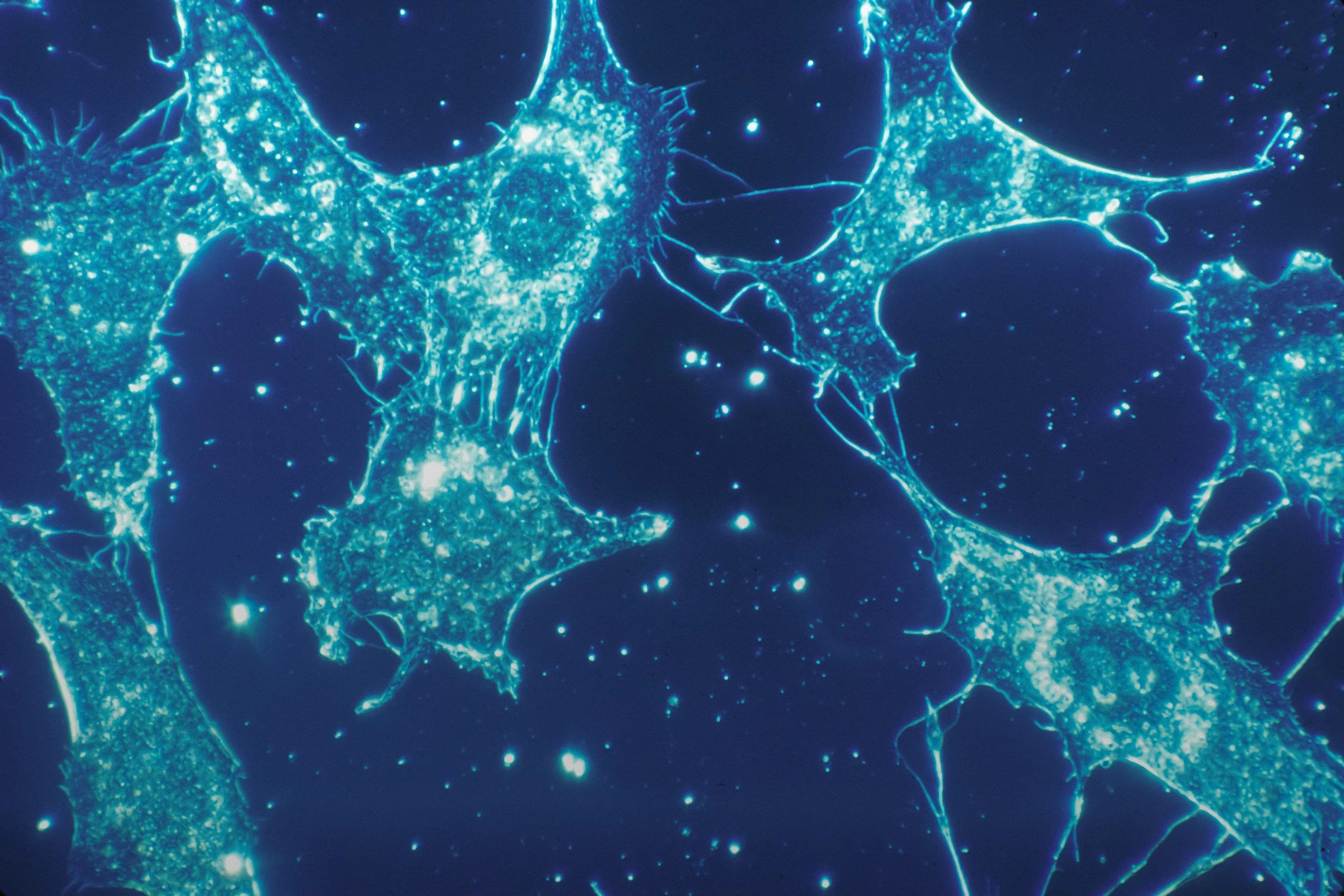 Microscopic view of neurons with glowing blue cell bodies and long branching axons and dendrites.