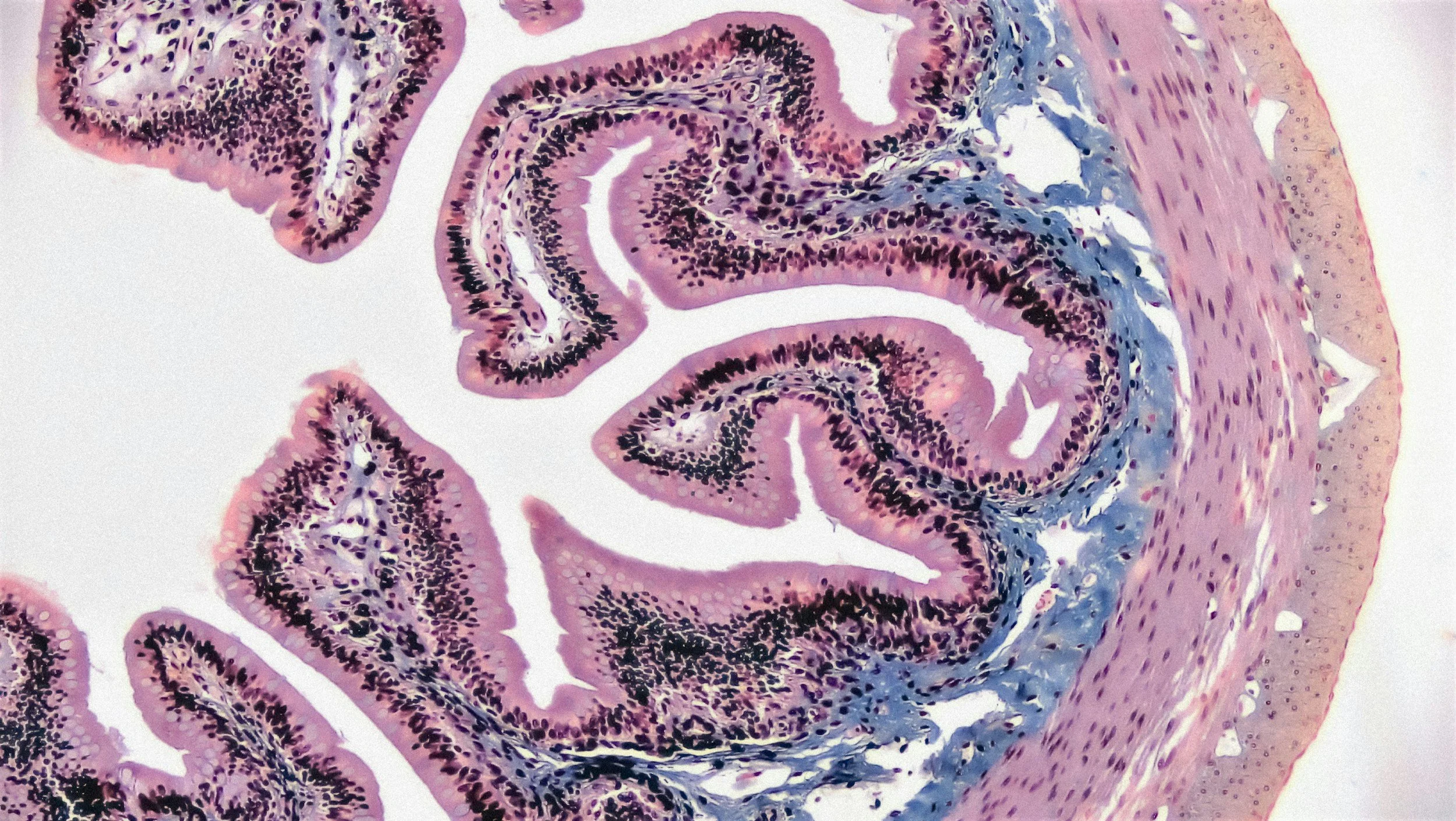 Microscopic image of a cross-section of biological tissue showing layered and folded structures with stained cells in shades of purple, pink, and blue.