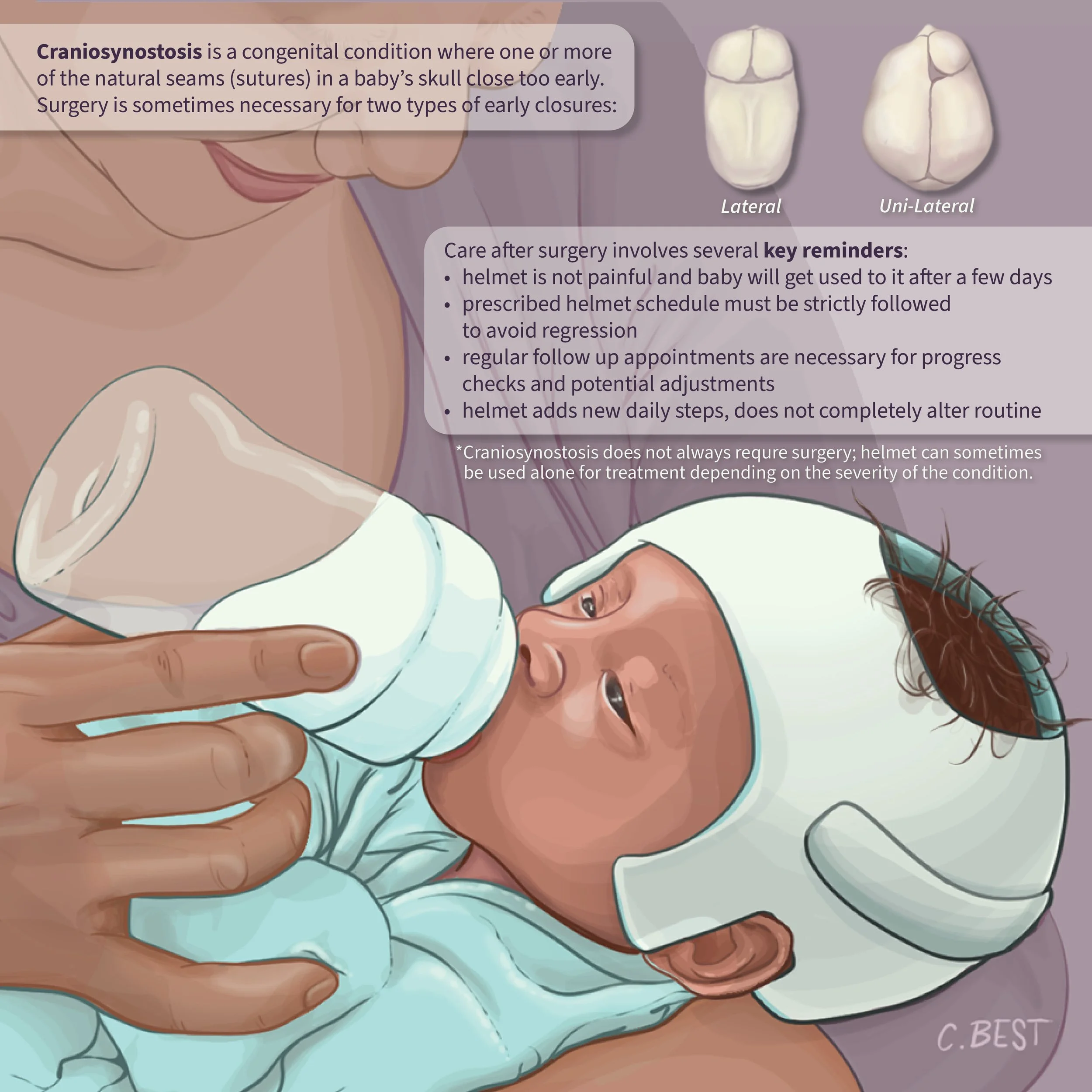 ChloeBest_PatientWeb_Craniosynostosis_20260226.jpg