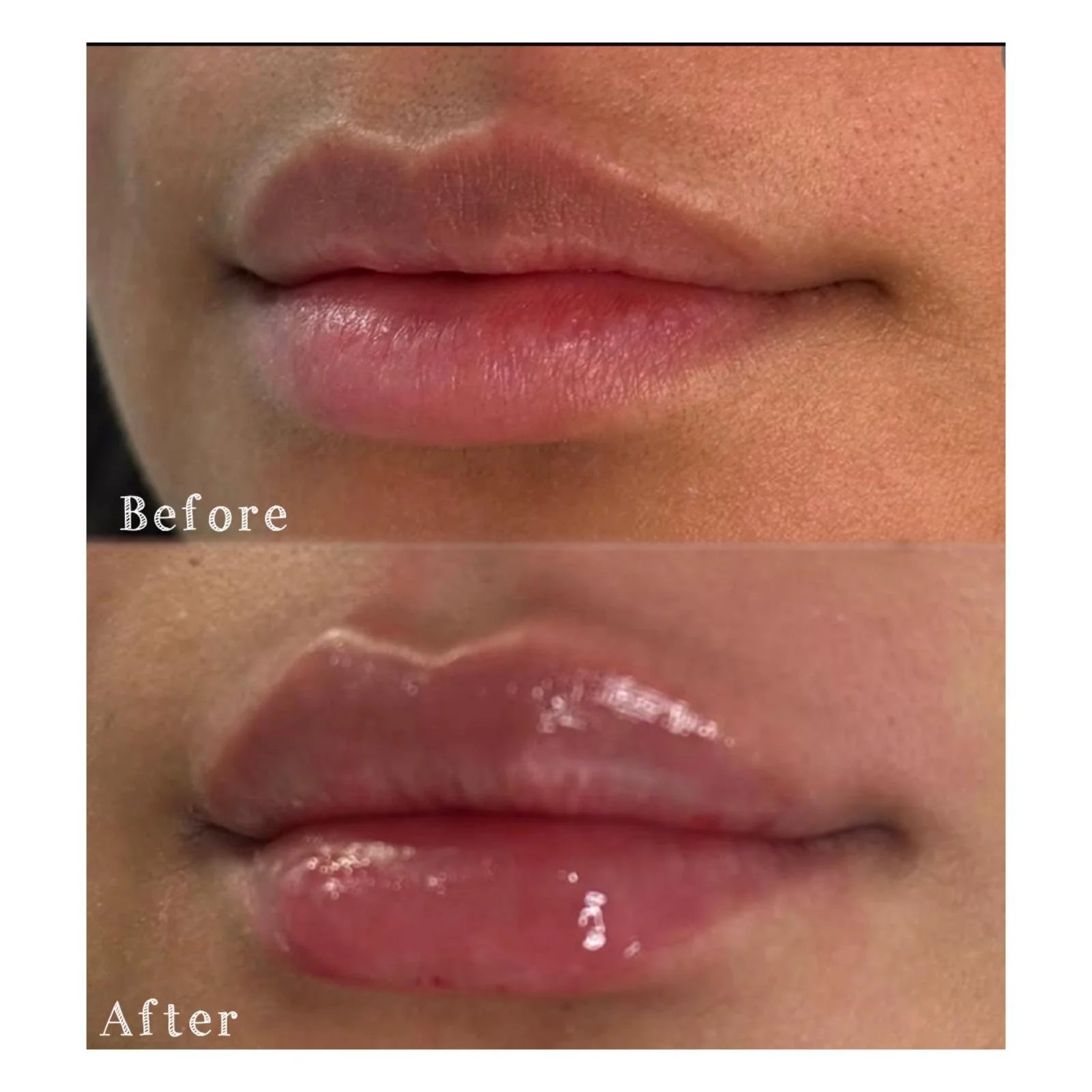 Close-up photograph of a person's lips, showing before and after images. The 'before' lips appear dry and chapped, while the 'after' lips look smoother and more moisturized.