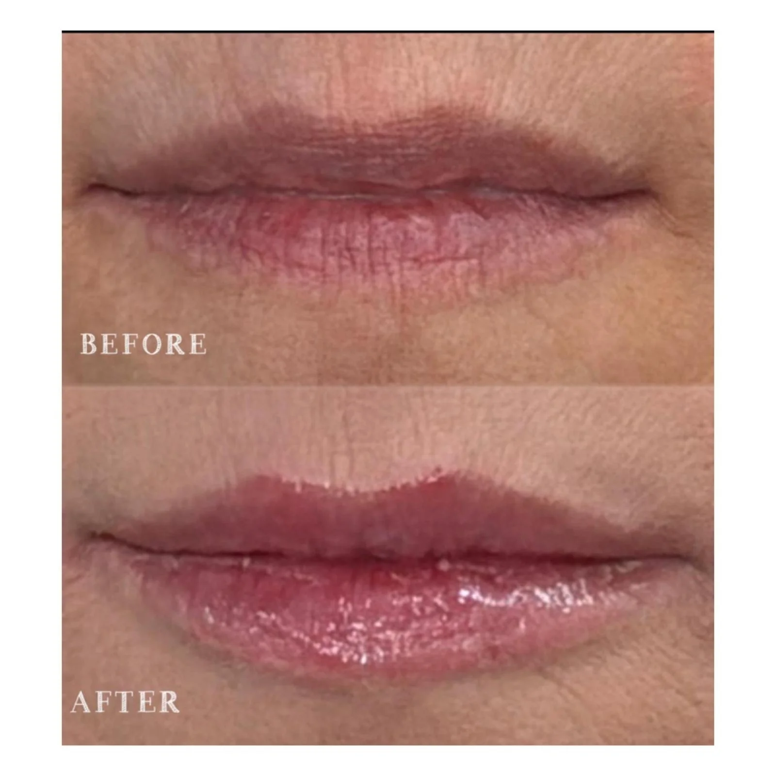 Comparison of lips showing a 'before' and 'after' result, with the 'before' lips appearing dry and chapped, and the 'after' lips looking more moisturized and smooth.
