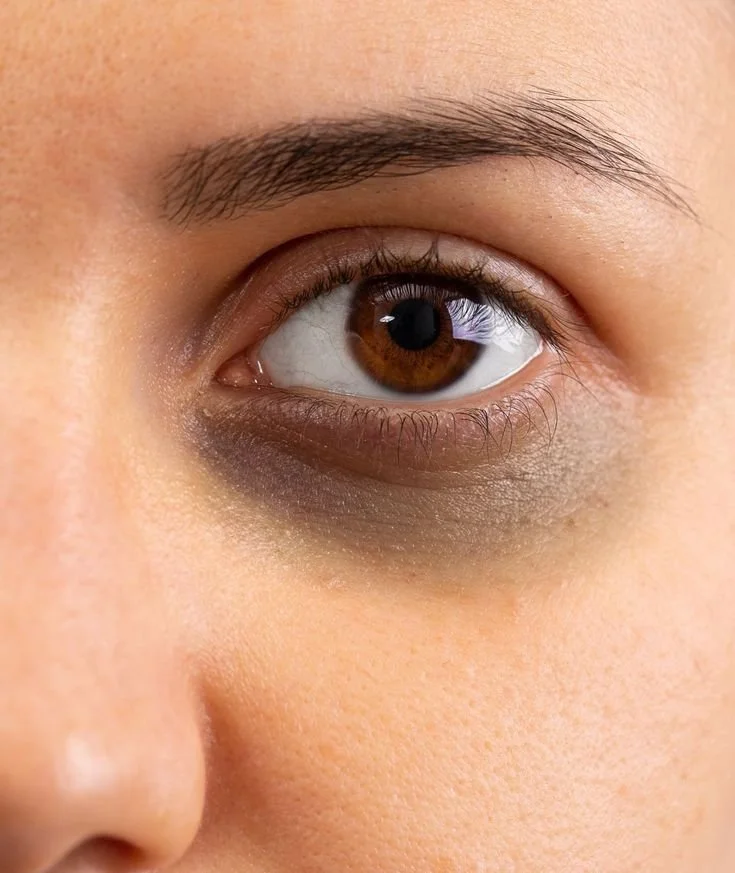 Close-up of a human eye with brown iris, surrounded by skin with natural complexion, with visible eyelashes and eyebrow hairs.