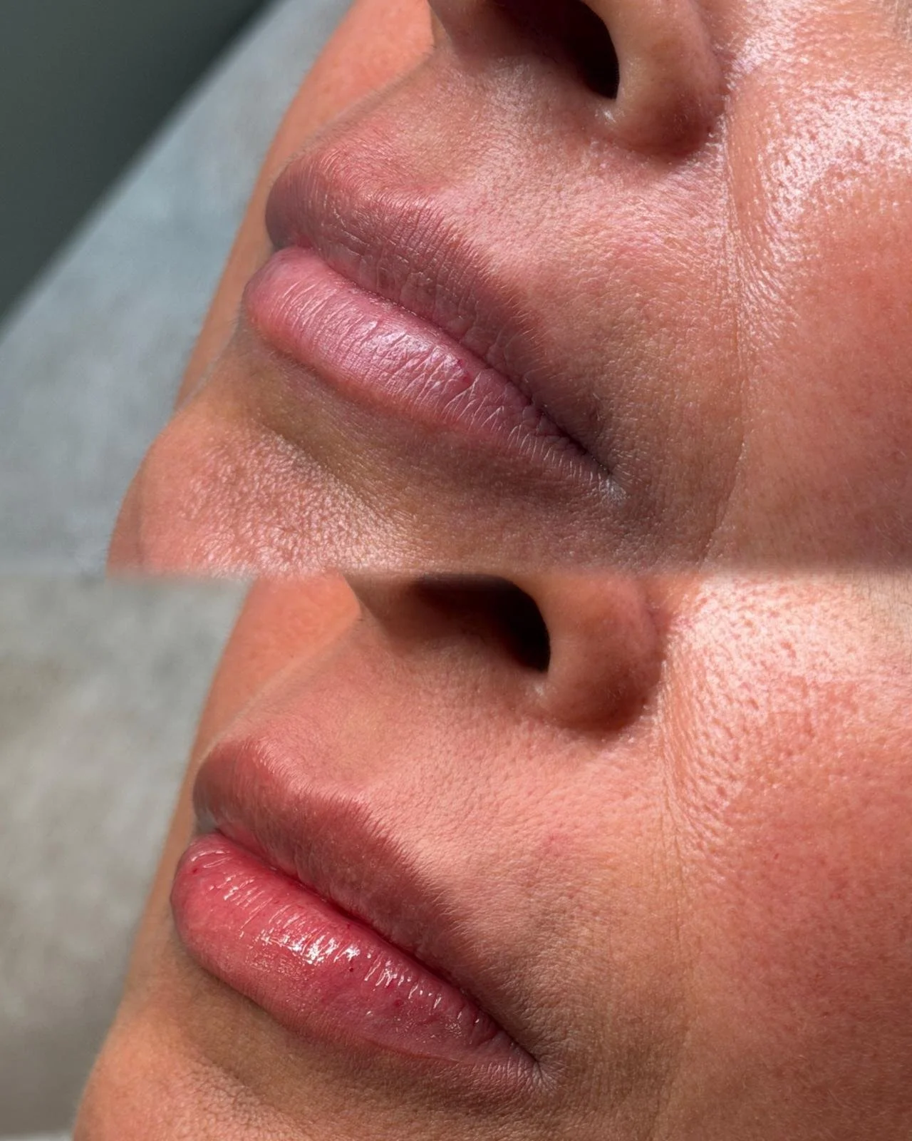 Close-up of a person's nose and lips, showcasing natural skin texture and lip detail.
