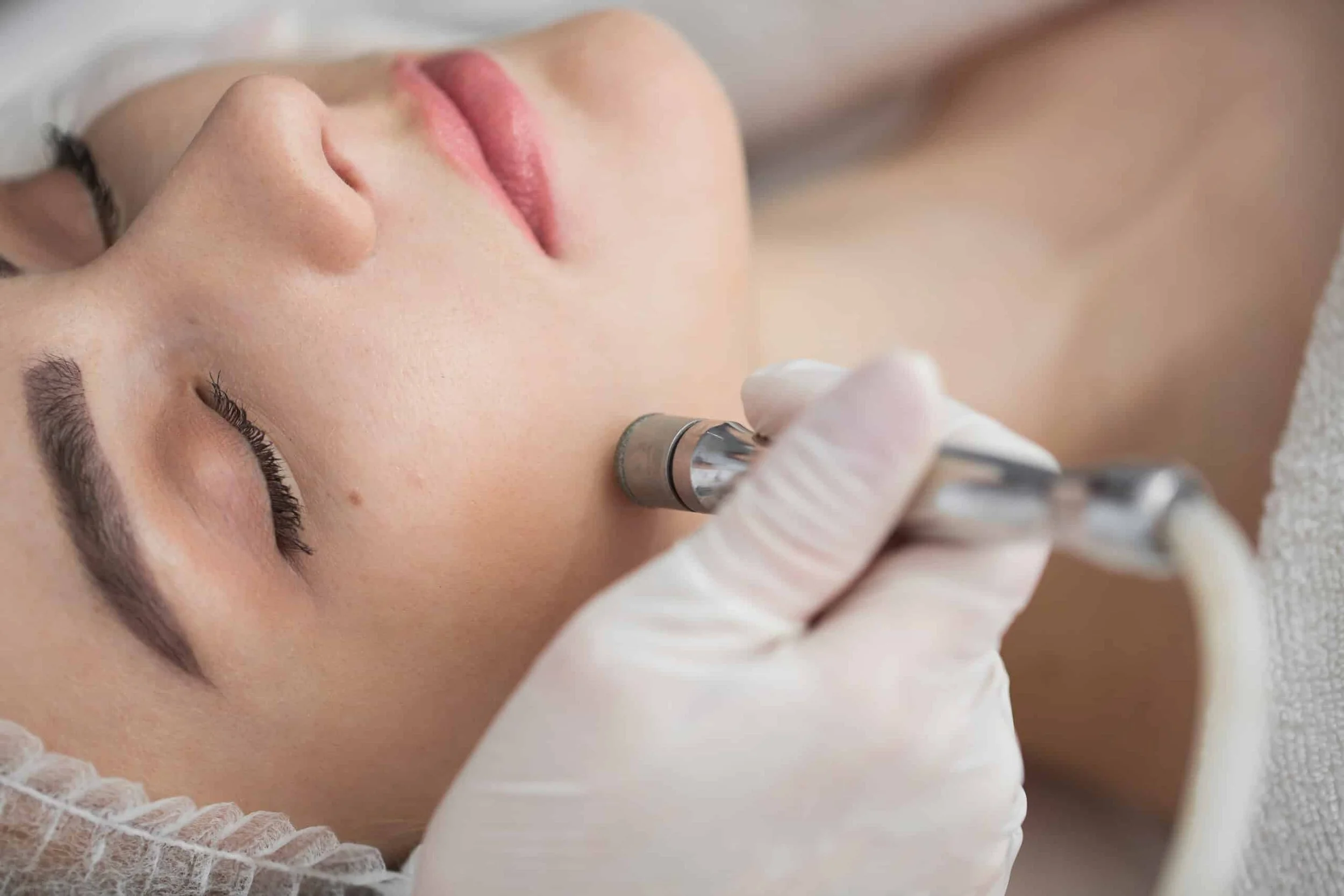 Microdermabrasion + Dermaplaning