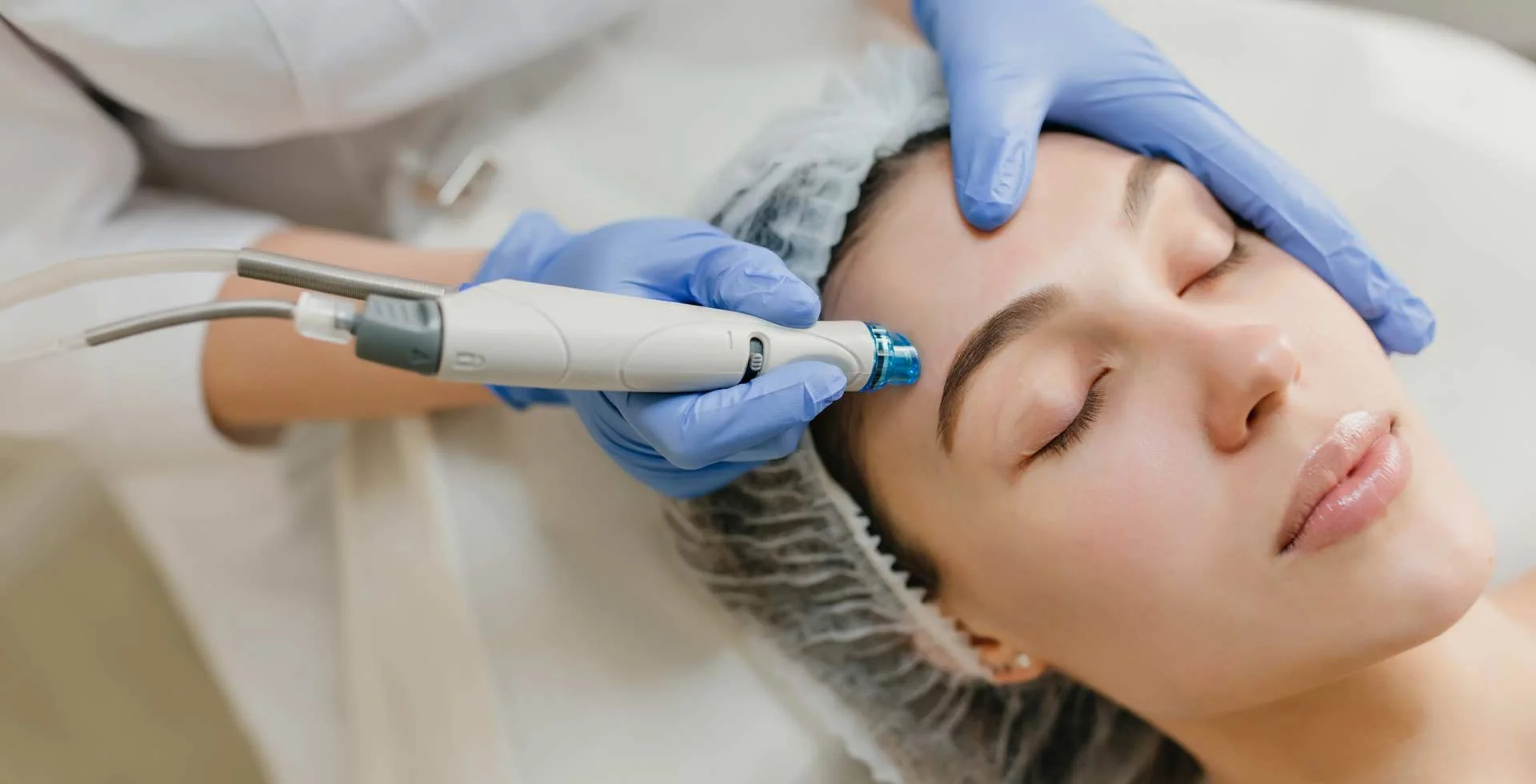 Microneedling